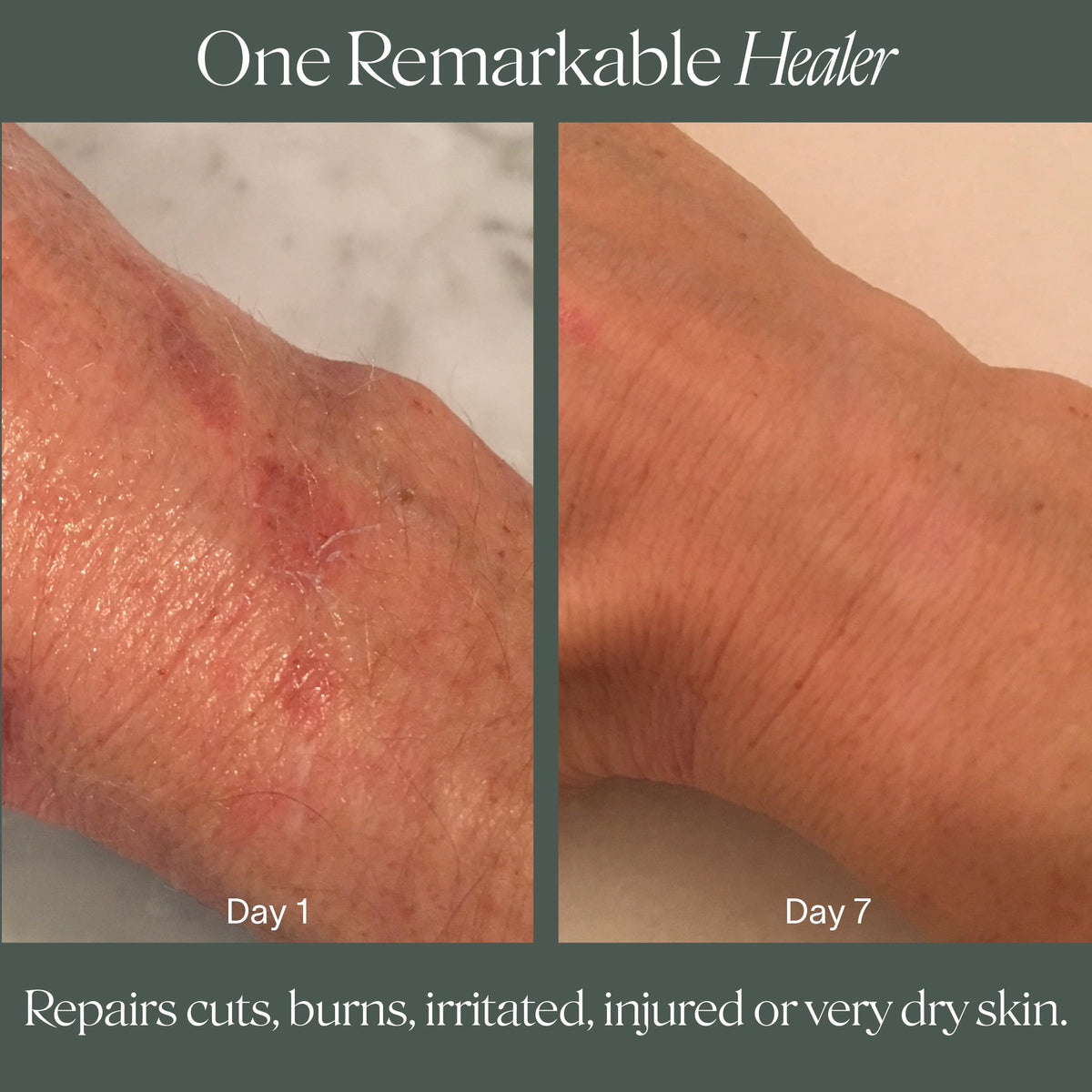 Doctor Rogers Restore Healing Balm Multi Purpose Healing - Doctor Rogers Re Official Imagery - 7