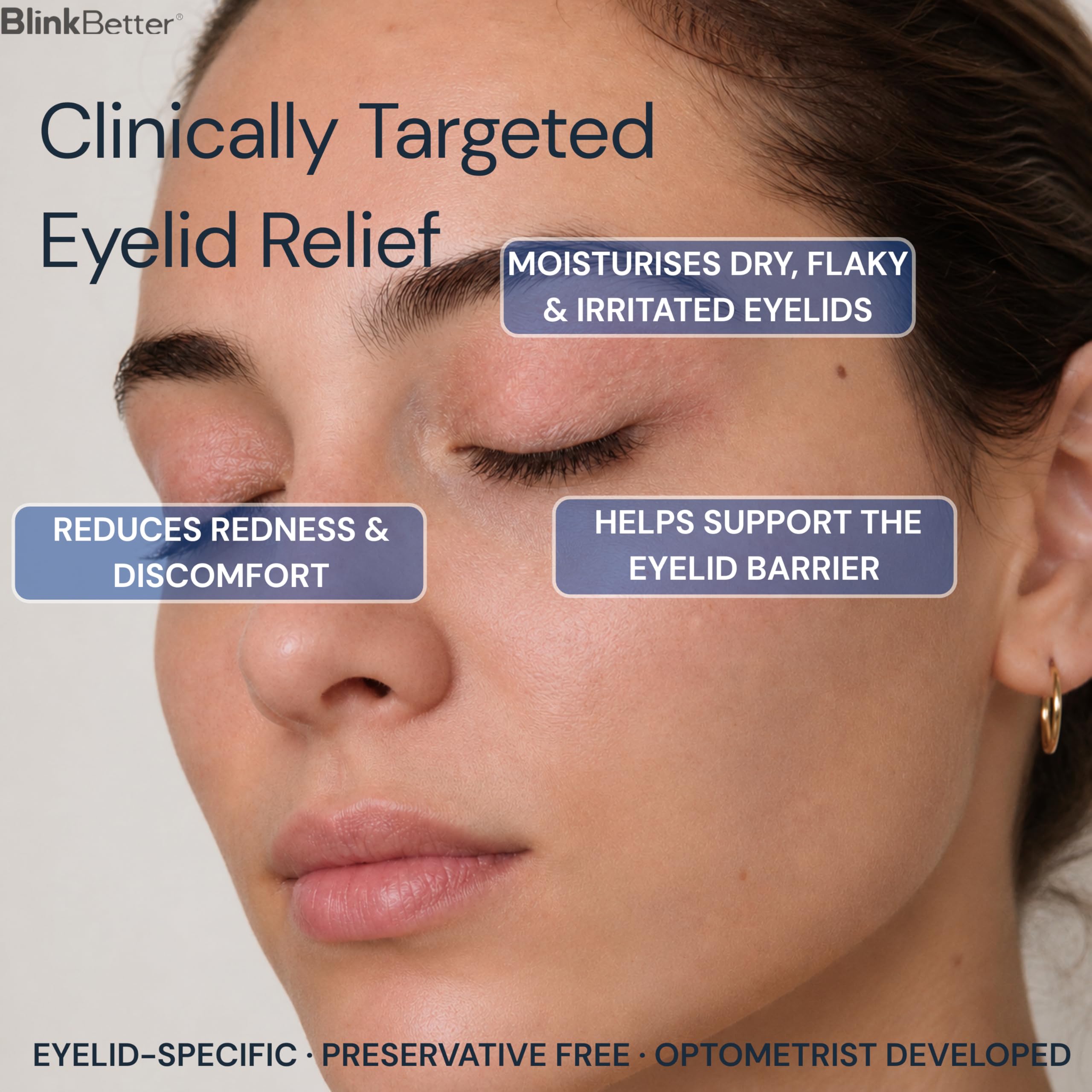 BlinkBetter BetterLids Eyelid Ointment for Dry, Itchy & Sensitive Eyelids – Deep-Moisturising Oat Complex with Shea Butter & Panthenol to Hydrate, Nourish & Soothe Delicate Eyelid Skin – 0.34 oz