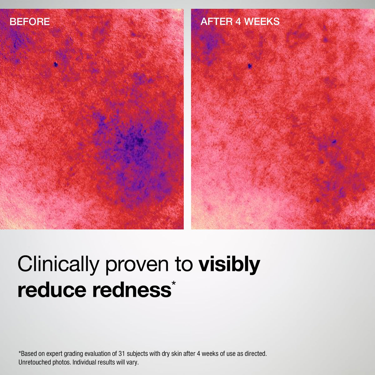 StriVectin Barrier Restore Soothing Milky Face Mist with - Premium Selection Official Imagery - 7