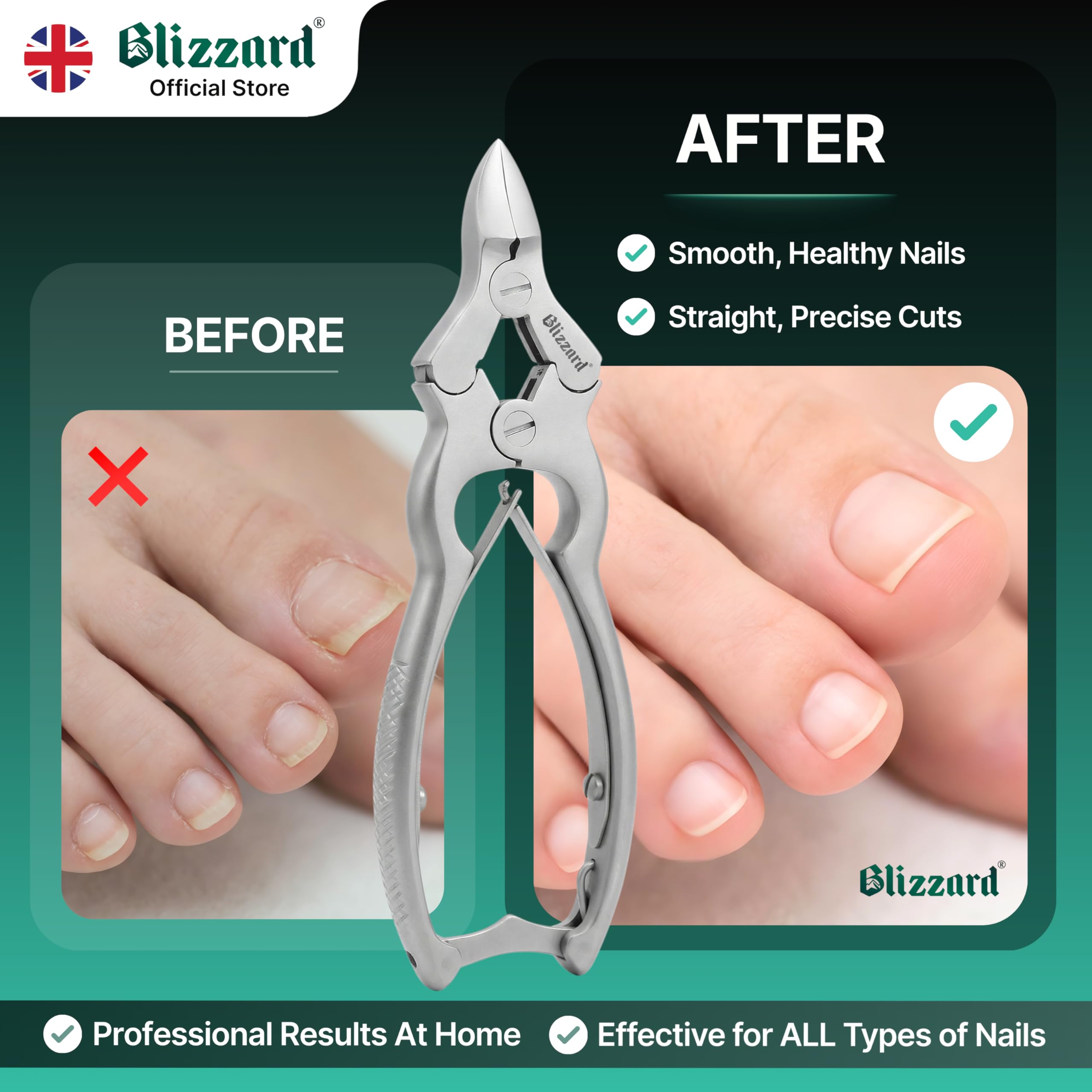 Blizzard Heavy Duty Toenail Clippers – German Steel