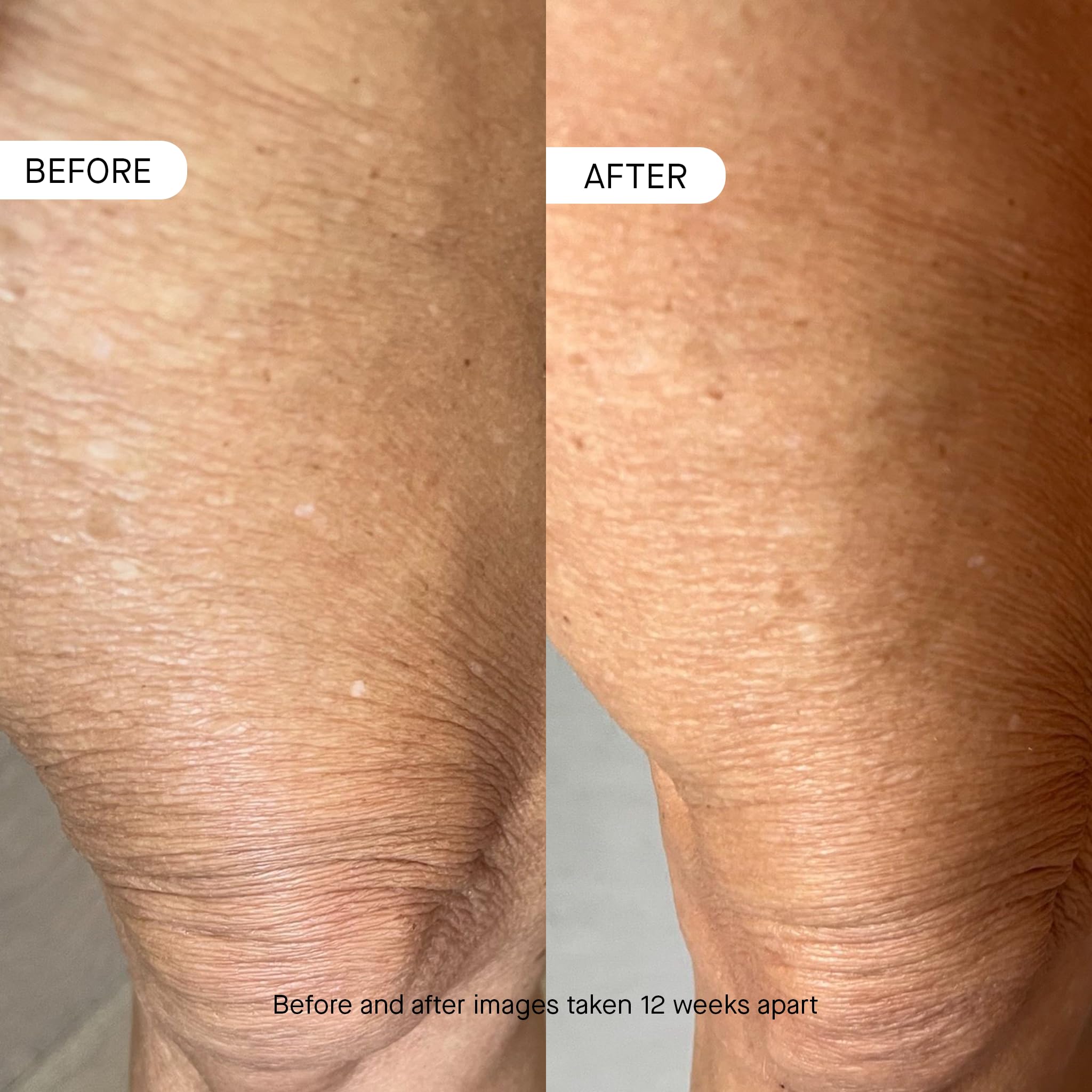OneSkin OS-01 BODY Topical Supplement Moisturizer | Age Reversal, 8.45 Oz - Elefair Tech Official Product View 5