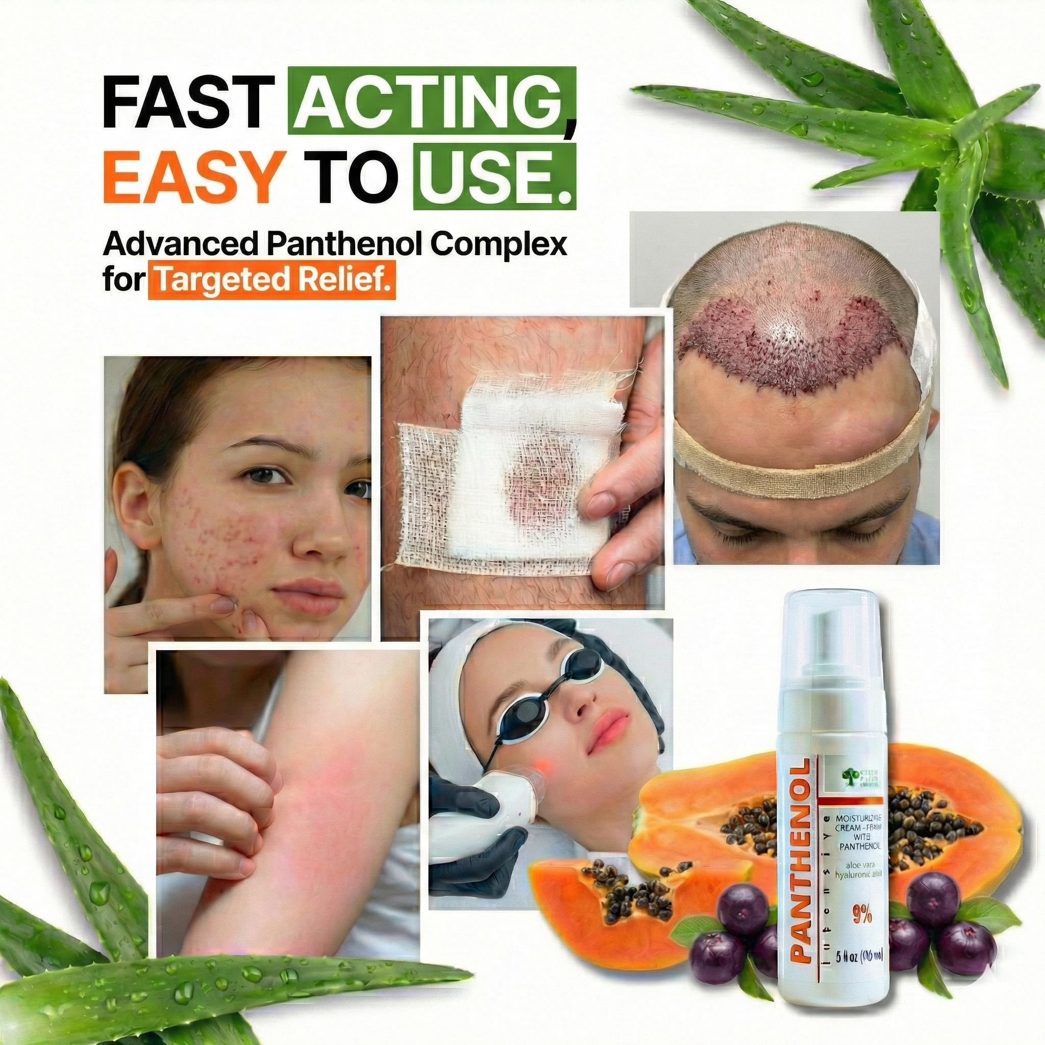 9% Panthenol Foam Spray – After Sun, Redness & Barrier Repair