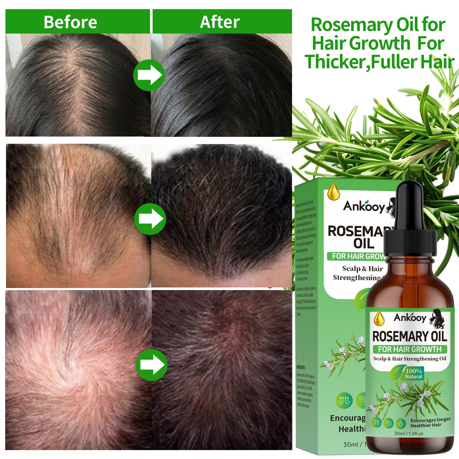 ANKOOY Rosemary Oil for Hair Growth,Rosemary Hair Growth Oil,Strengthening Oil - ANKOOY Official Product View 4