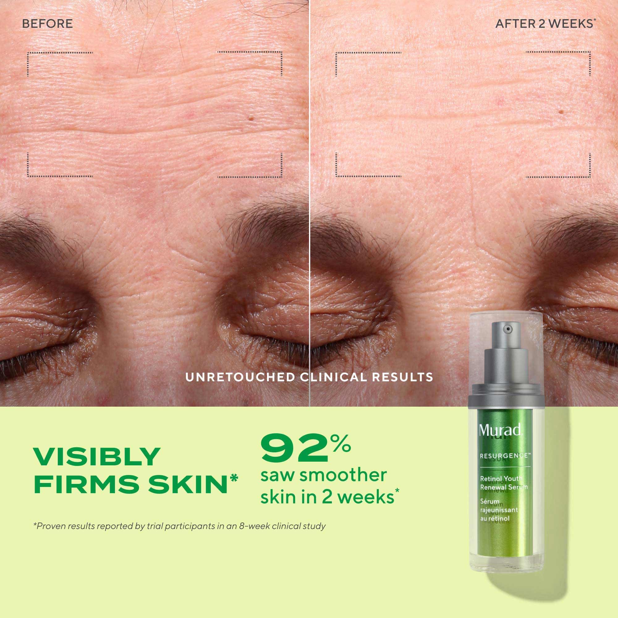 Murad Retinol Youth Renewal Serum - Premium Selection Official Imagery - 4