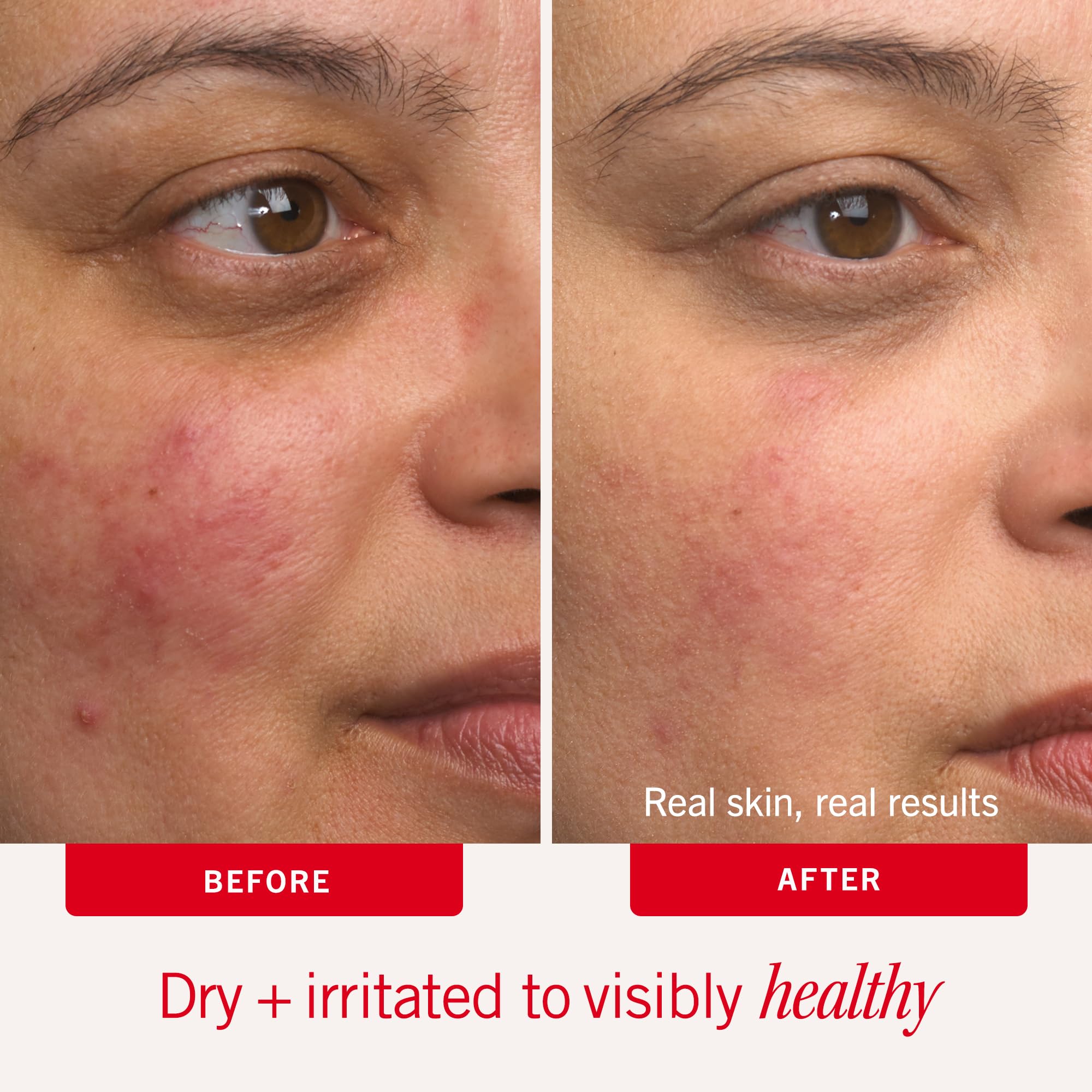 Elefair Tech First Aid Beauty Ultra Repair Cream, Intense Hydration - - Elefair Tech Official Product View 5