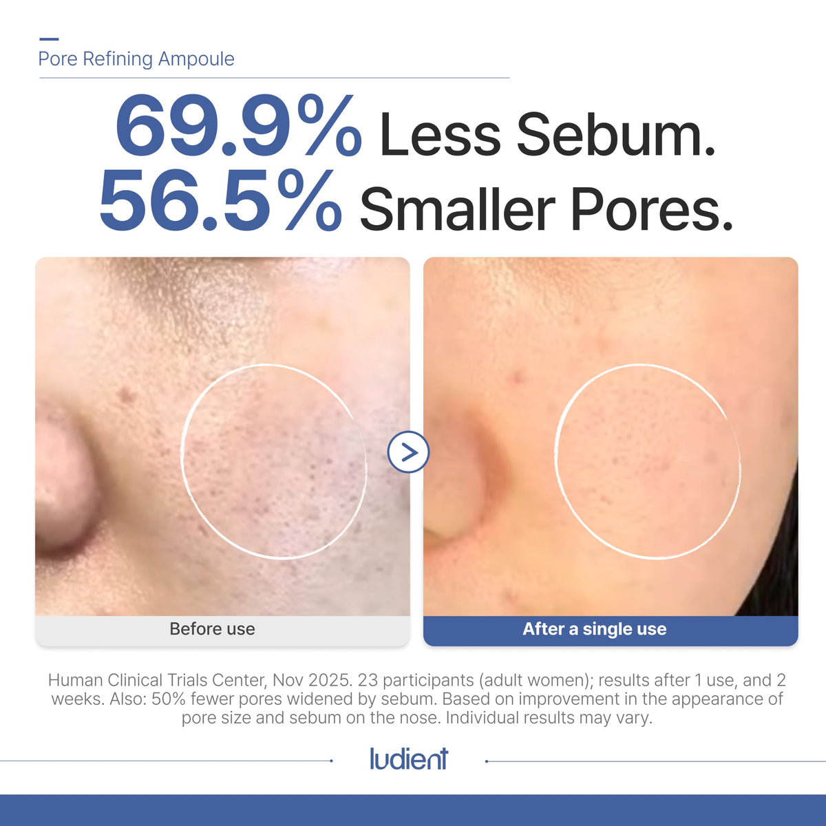 Pore Minimizer for Face Korean Retinol Serum for Face 1 01 - ludient Official Product Imagery - 3