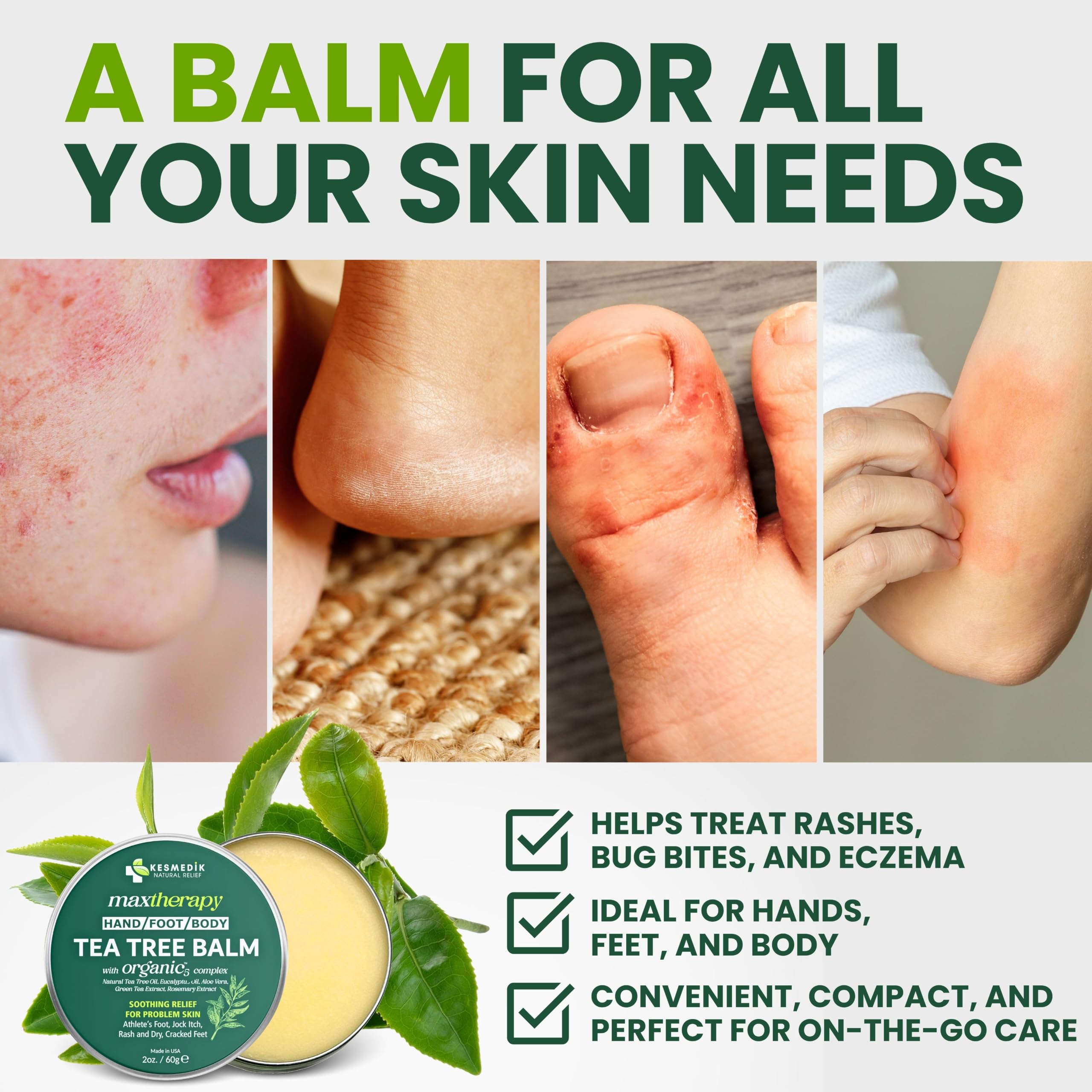 Kesmedik Tea Tree Oil Balm, antifungal skin moisturizer, showing a tube of KESMEDIK skin relief balm on a white background.