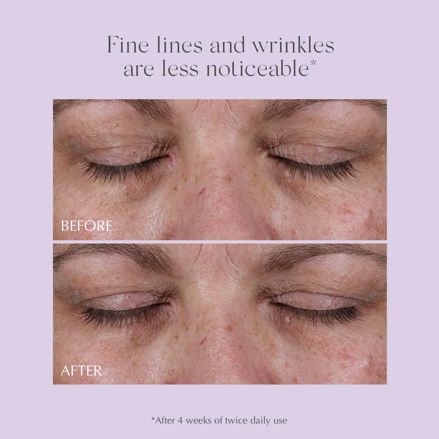 EXUVIANCE AGE REVERSE Total 360 Eye Contour Anti Aging Eye - Premium Selection Official Imagery - 8