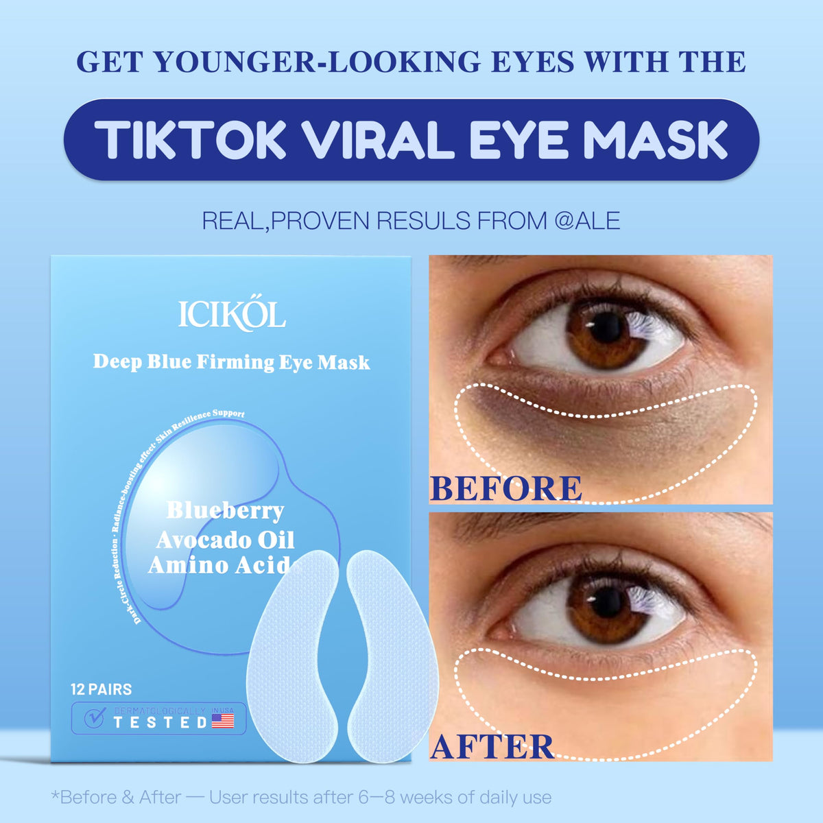 Blueberry Collagen Under Eye Patches Eye Mask for Puffy Eyes - ICIKOL Official Imagery - 3