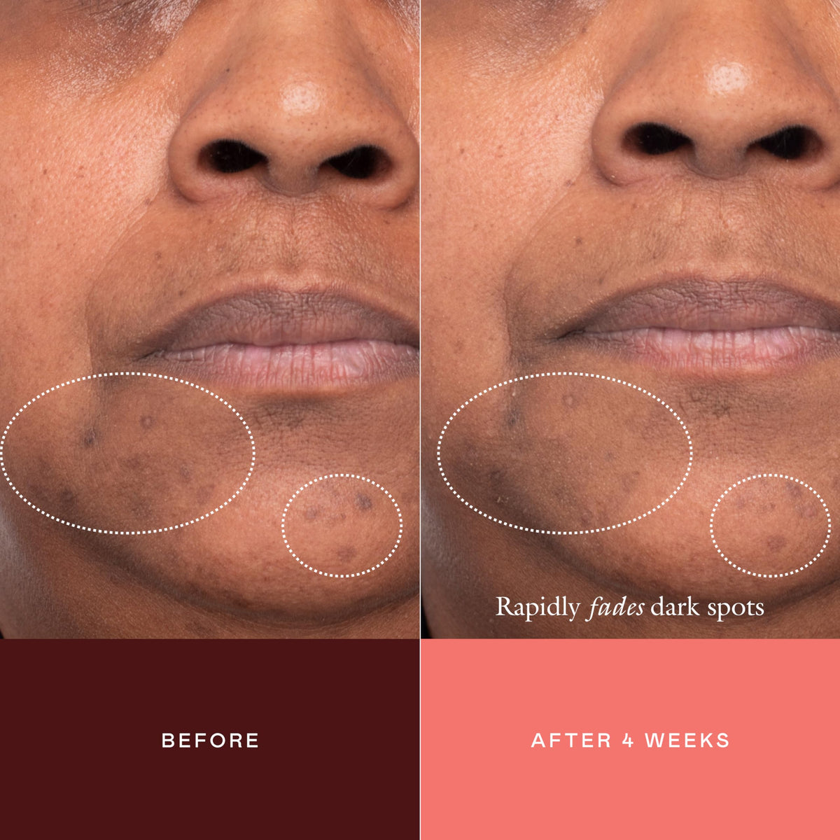 EADEM Advanced Dark Spot Concentrate Serum for Face with - EADEM Official Imagery - 6