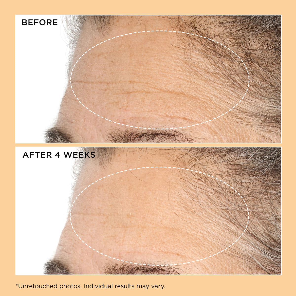 Perricone MD Neuropeptide Deep Crease Serum - Premium Selection Official Imagery - 8