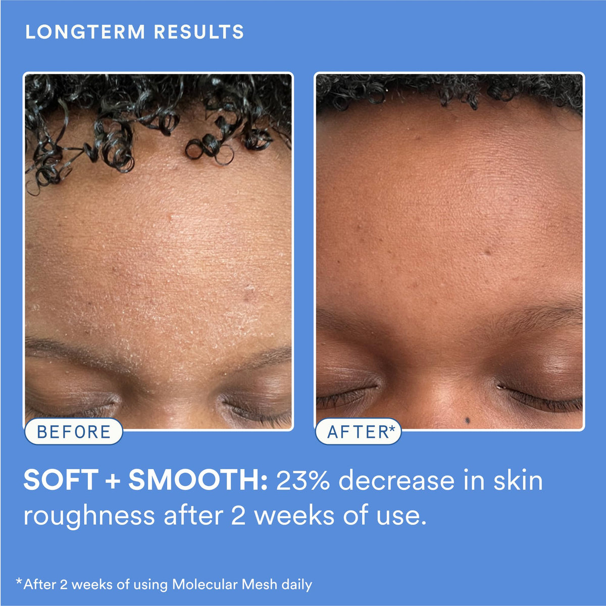 Experiment Molecular Mesh Barrier Repair Face Moisturizer - Experiment Official Imagery - 6