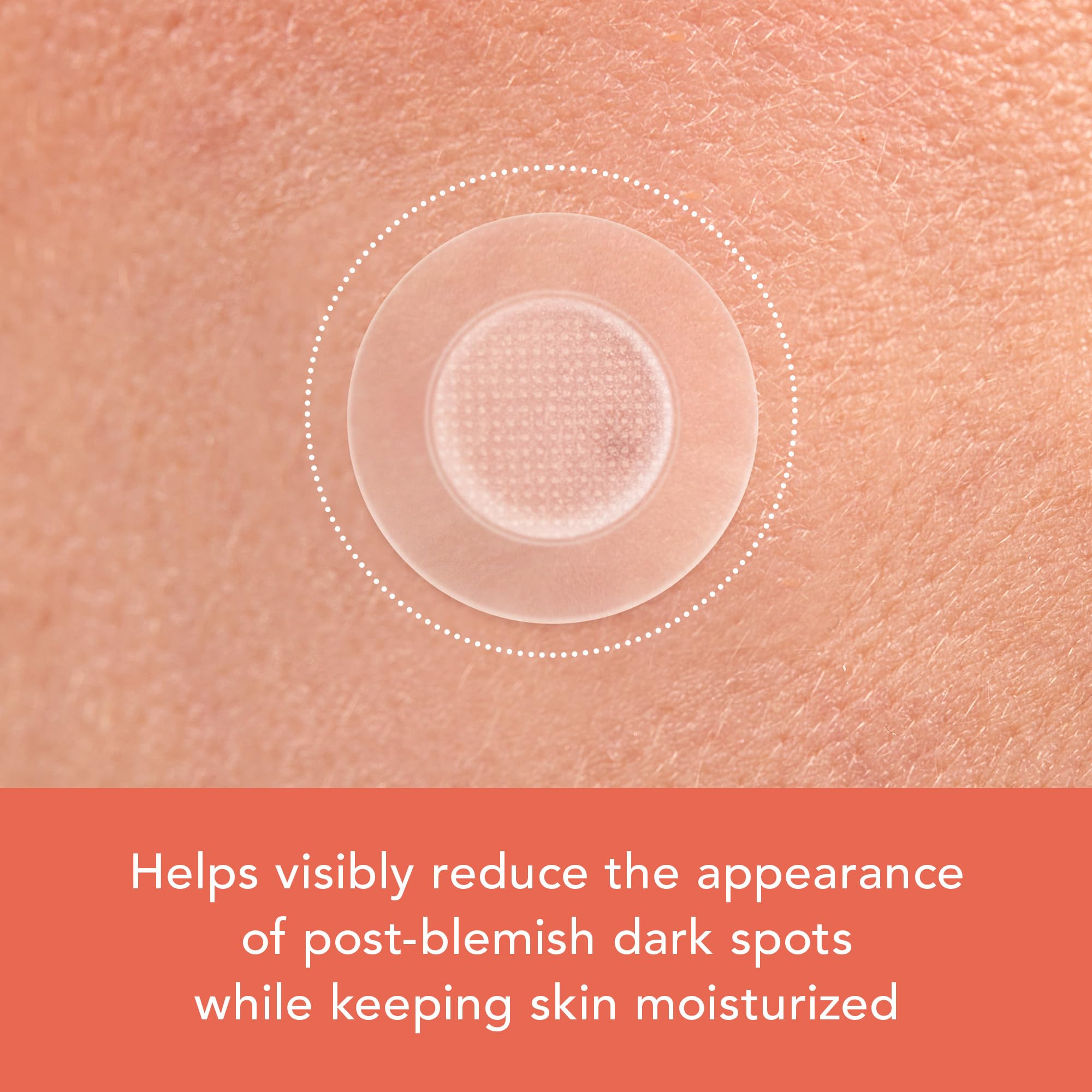 Rael Miracle Microcrystal Vitamin C Dark Spot Cover Pimple - Rael Official Product Imagery - 5