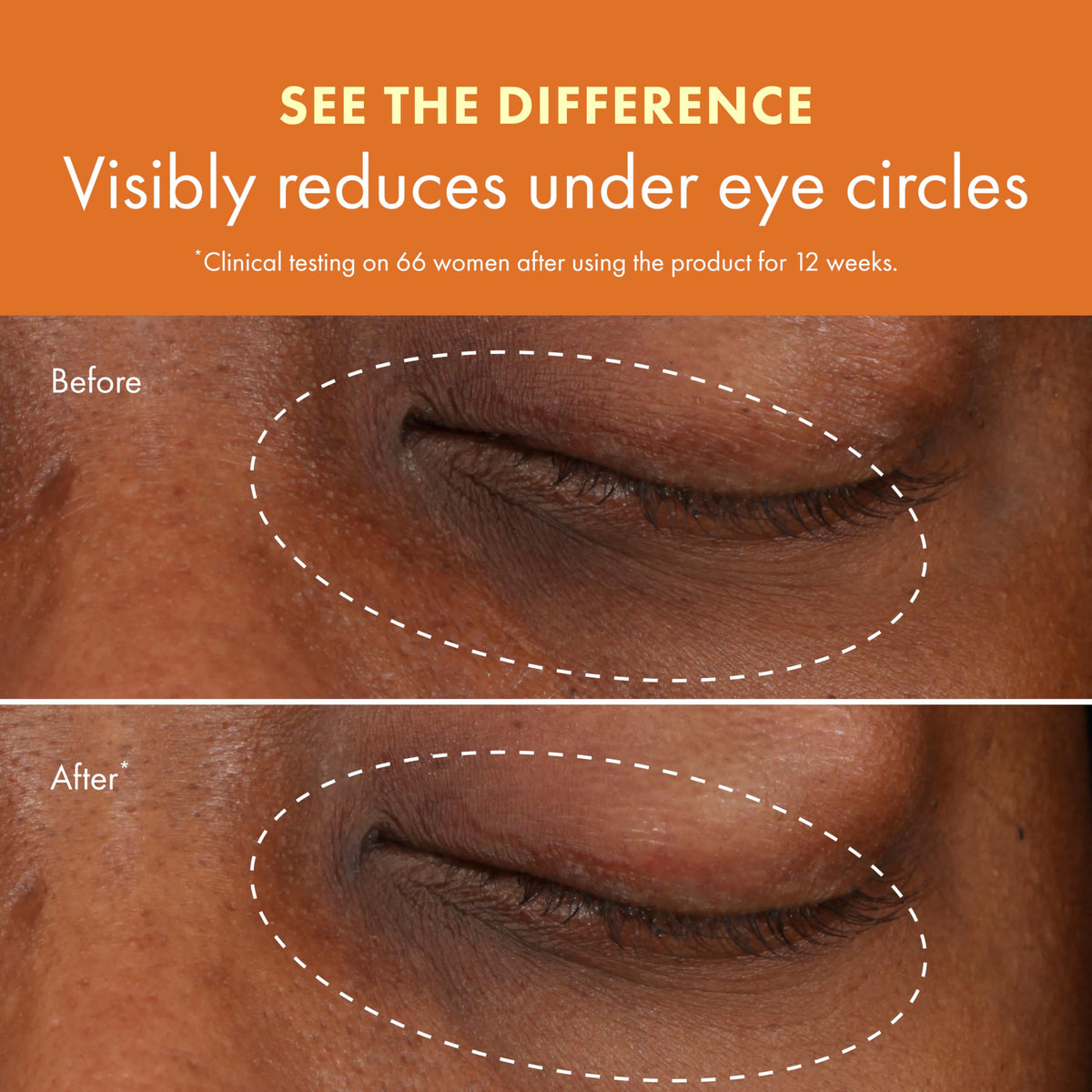 Origins GinZing Brightening Eye Cream with Vitamin C - Premium Selection Official Imagery - 6
