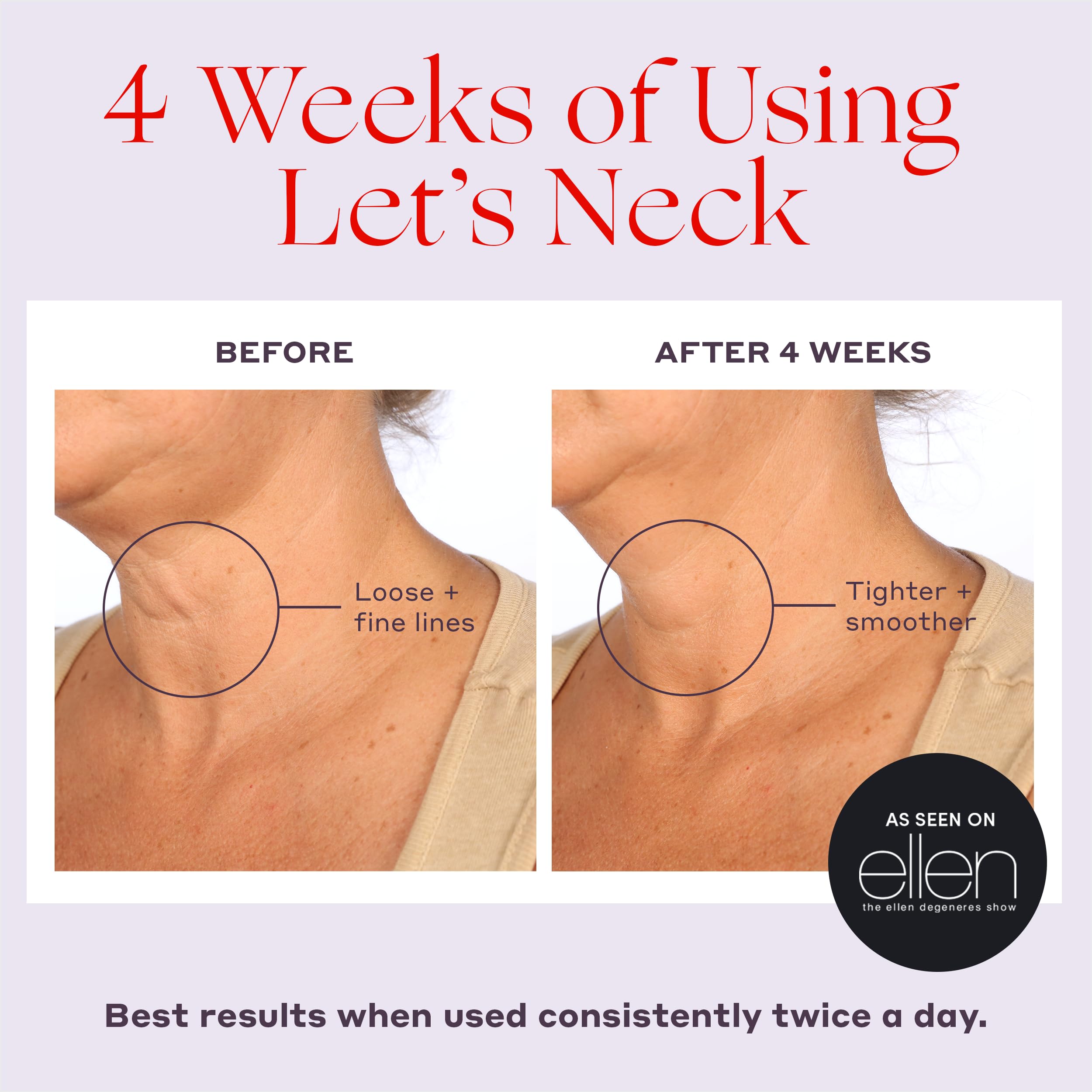 Womaness Let s Neck Serum for Neck Tightening and Lifting - Womaness Official Imagery - 5