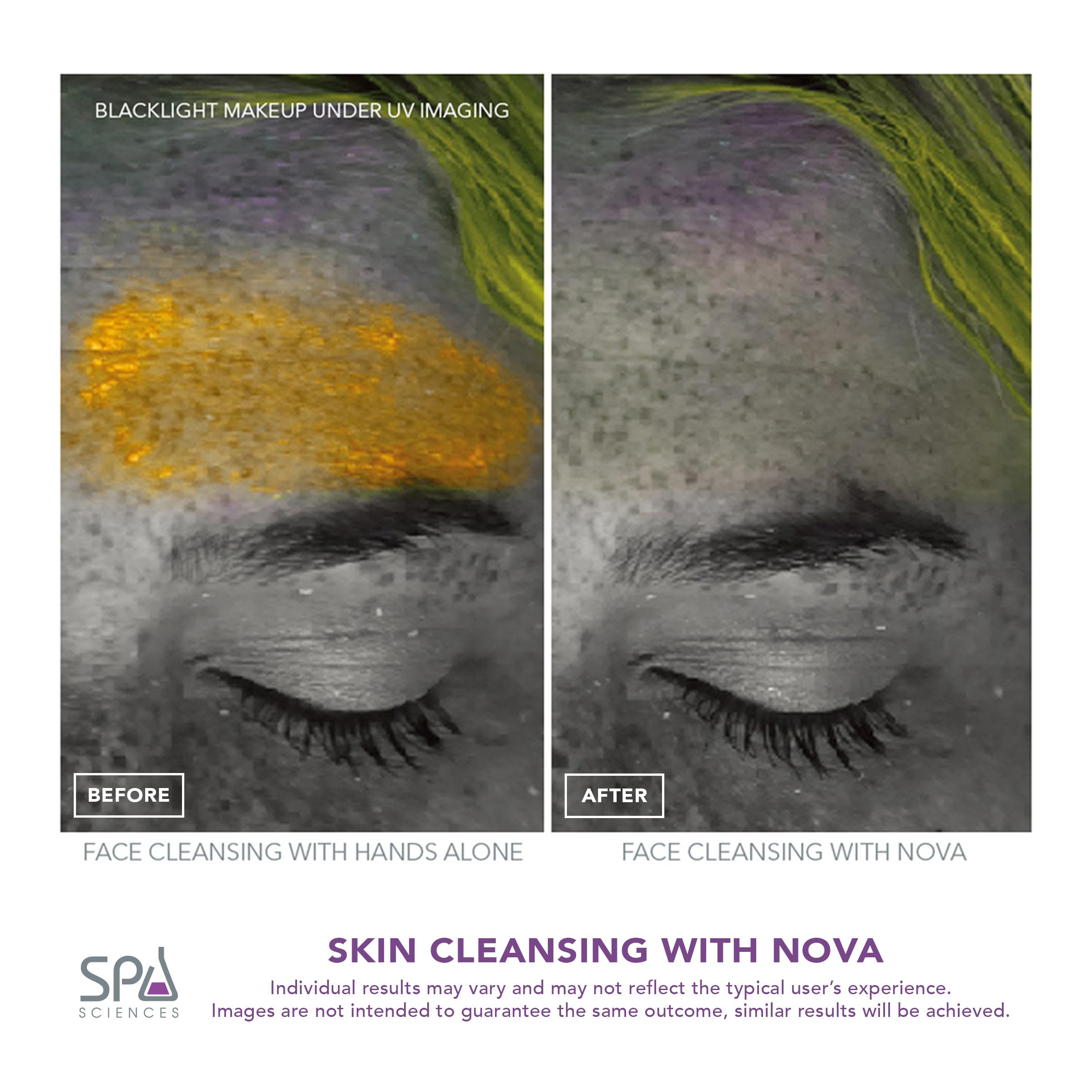Spa Sciences NOVA Sonic Facial Cleansing Brush – Pink