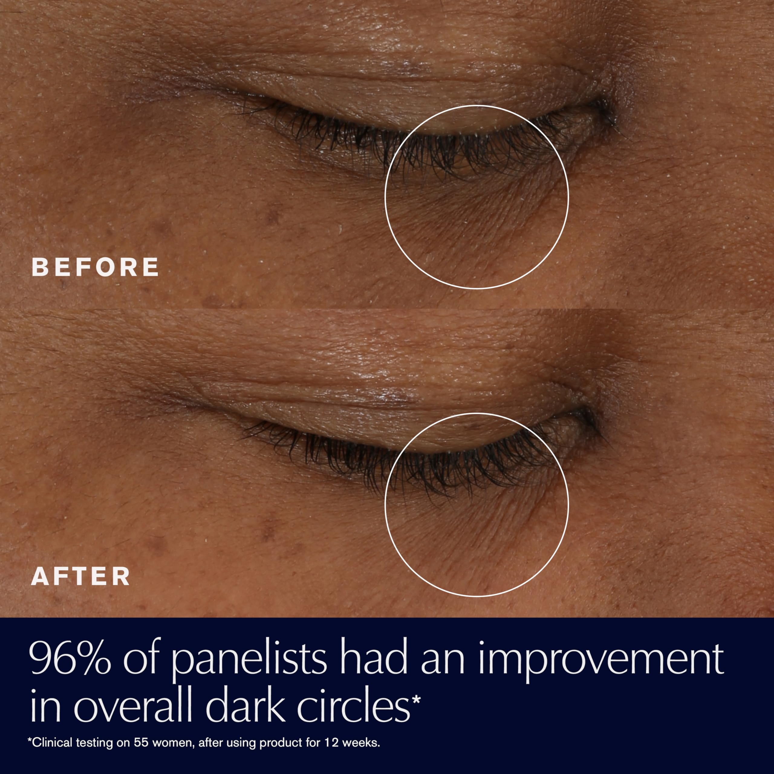 Elefair Tech Estée Lauder Advanced Night Repair Eye Supercharged Gel - Cream - Elefair Tech Official Product View 4