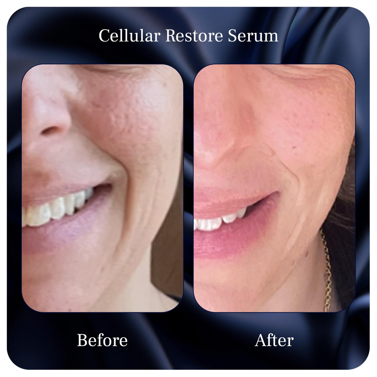 PUREANCE Cellular Restore Serum - PUREANCE Official Imagery - 6