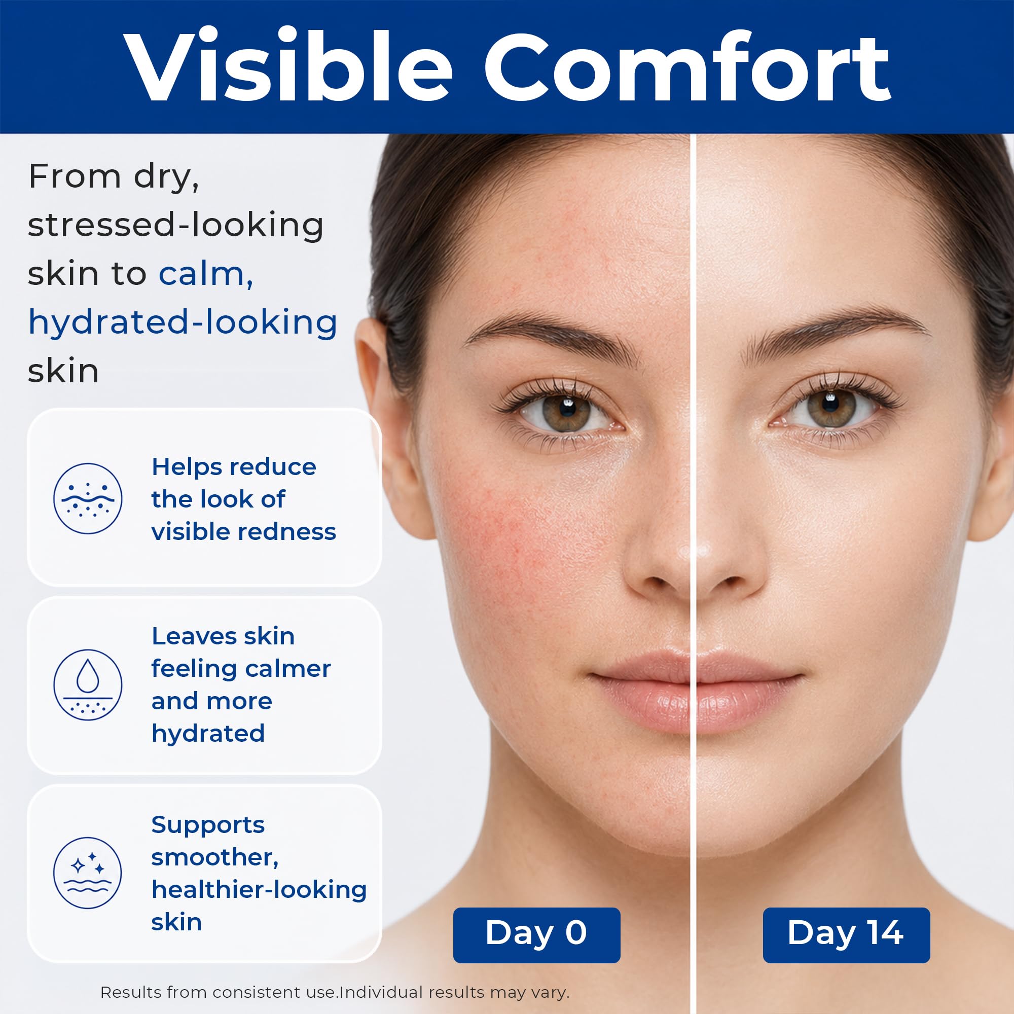 SKINERSE Intensive Repair Serum, 15%Hyaluronic Acid for Sensitive Skin Anti - SKINERSE Official Product View 7
