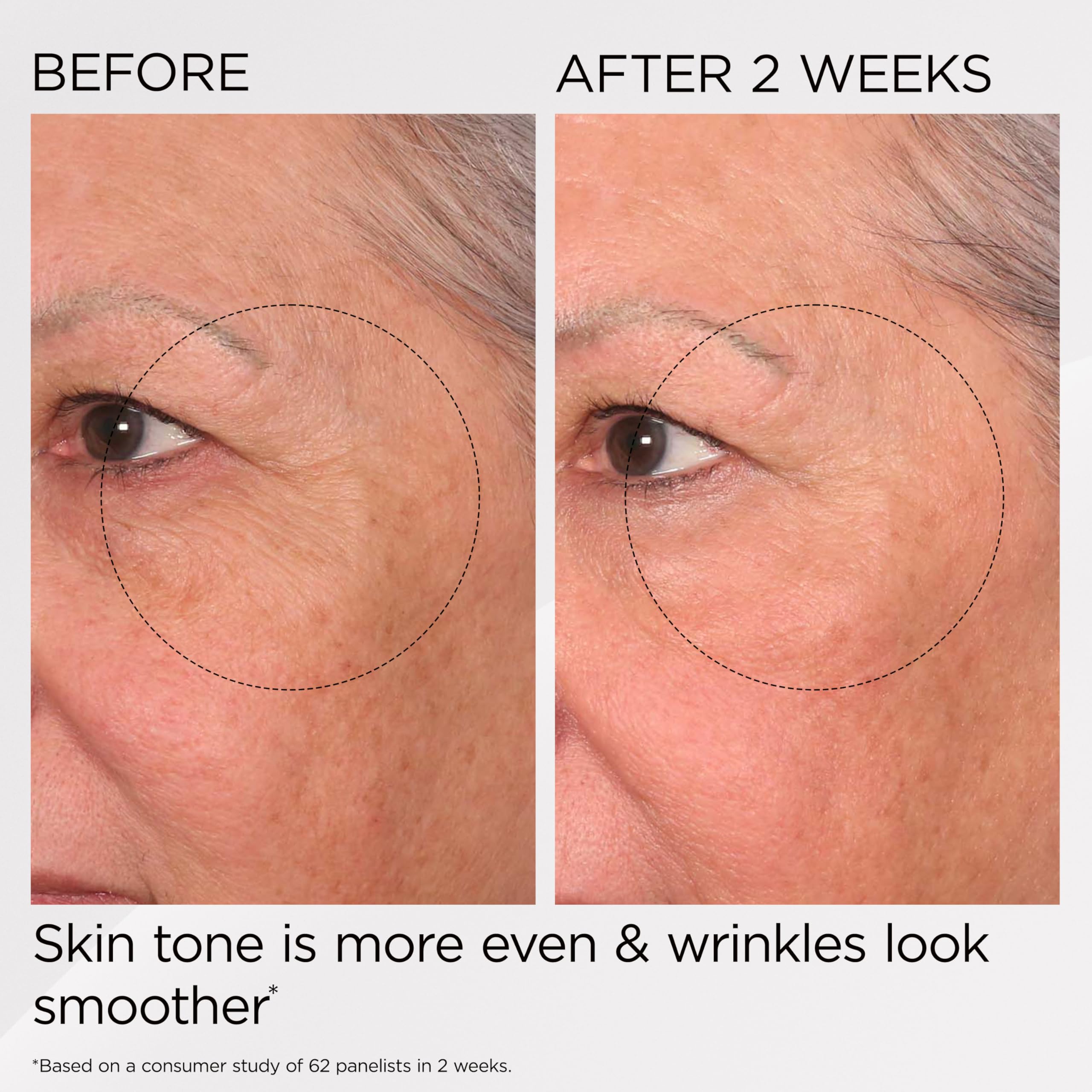 Elizabeth Arden PREVAGE Anti-Aging Face Moisturizer Cream for... - Elefair Tech Official Product View 6