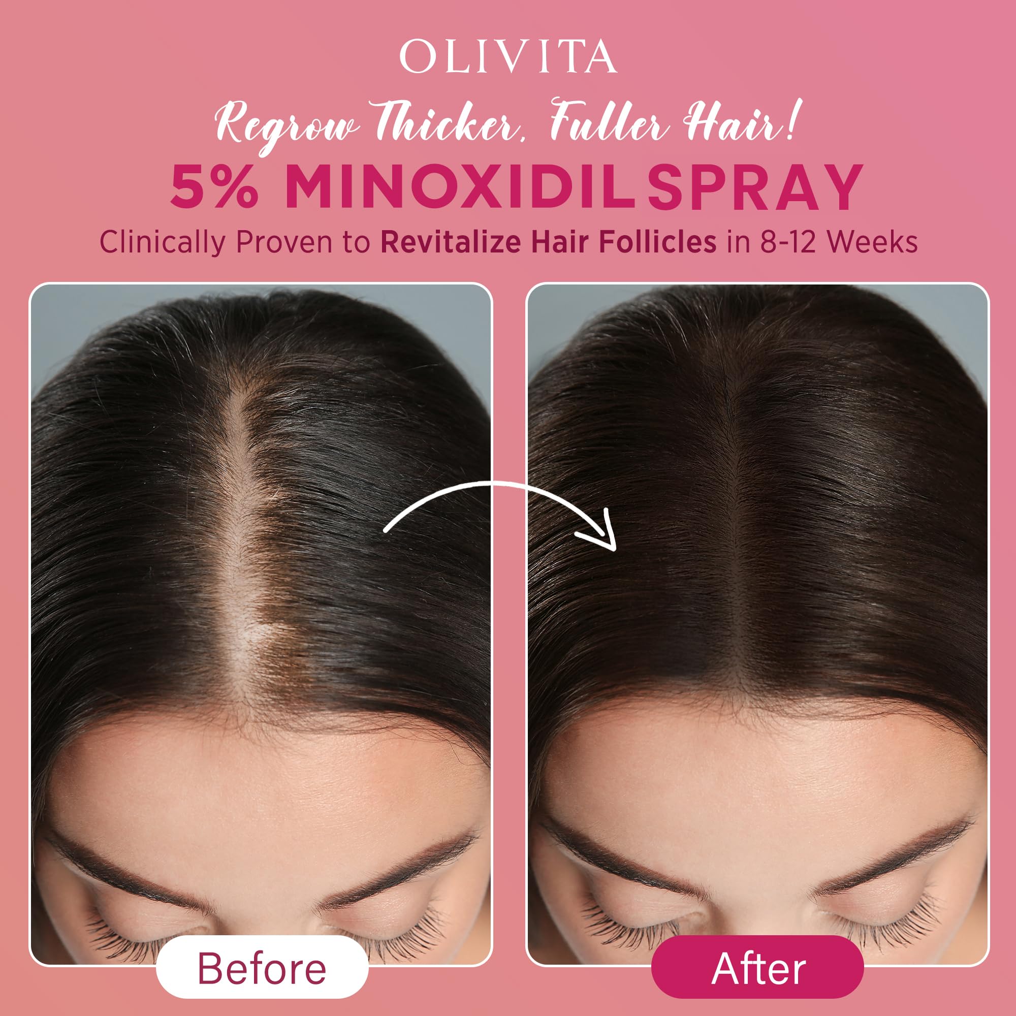 5 Minoxidil Spray for Women Hair Growth Extra Strength Hair - OLIVITA Official Imagery - 5