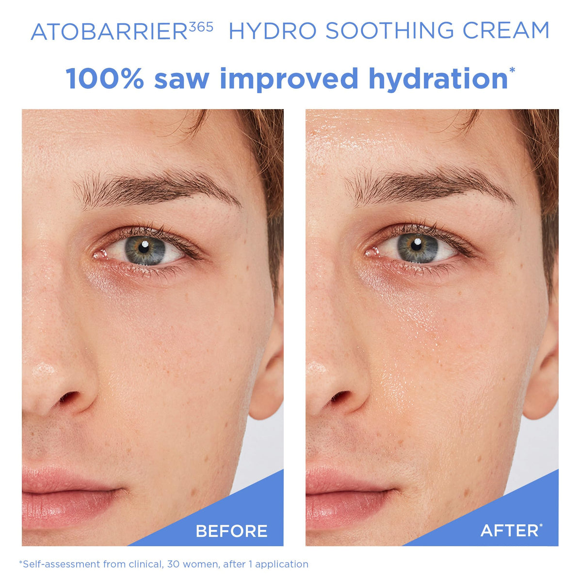 AESTURA ATOBARRIER365 Hydro Soothing Gel Cream Moisturizer - AESTURA Official Imagery - 6
