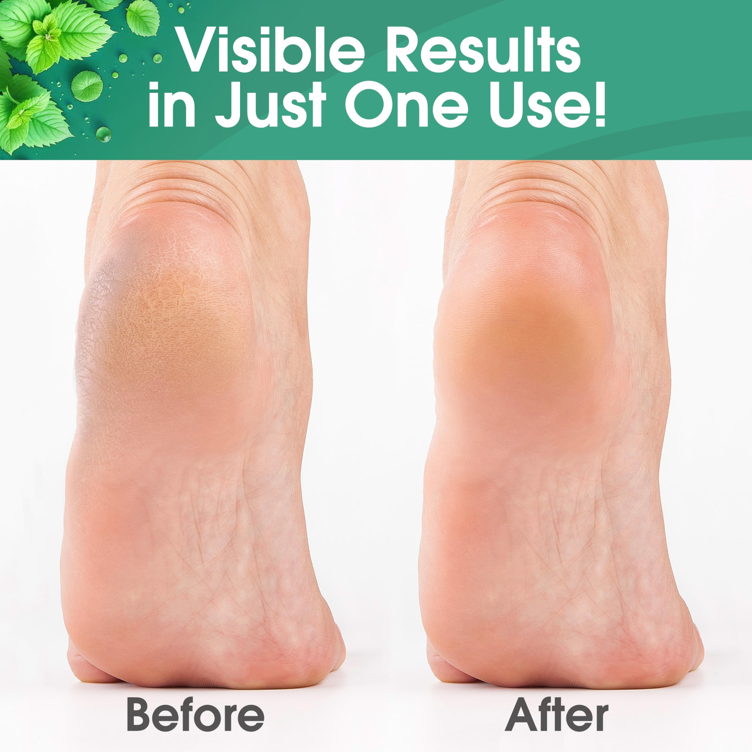 DeEnti Foot Callus Remover Gel in Cool Mint 8oz, showing the soothing gel bottle designed for foot care and callus removal.