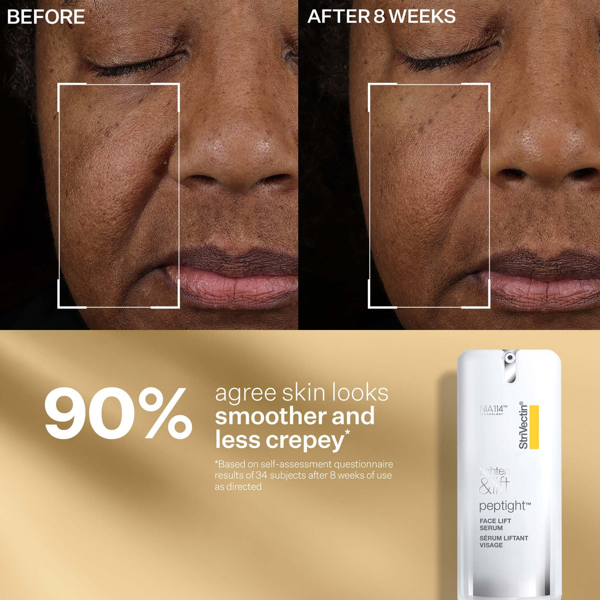 StriVectin Tighten Lift Peptight Face Lift Serum with - Premium Selection Official Imagery - 5