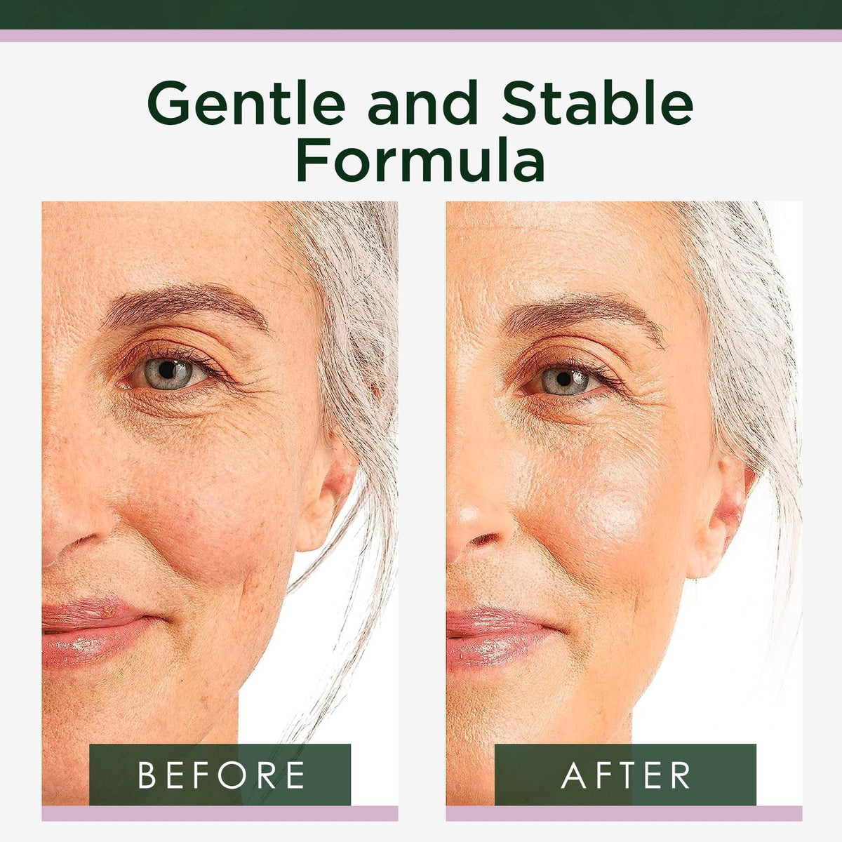 Tree of Life Retinol Serum for Face Anti Aging Face Oil 4 Fl - Tree of Life Official Imagery - 4