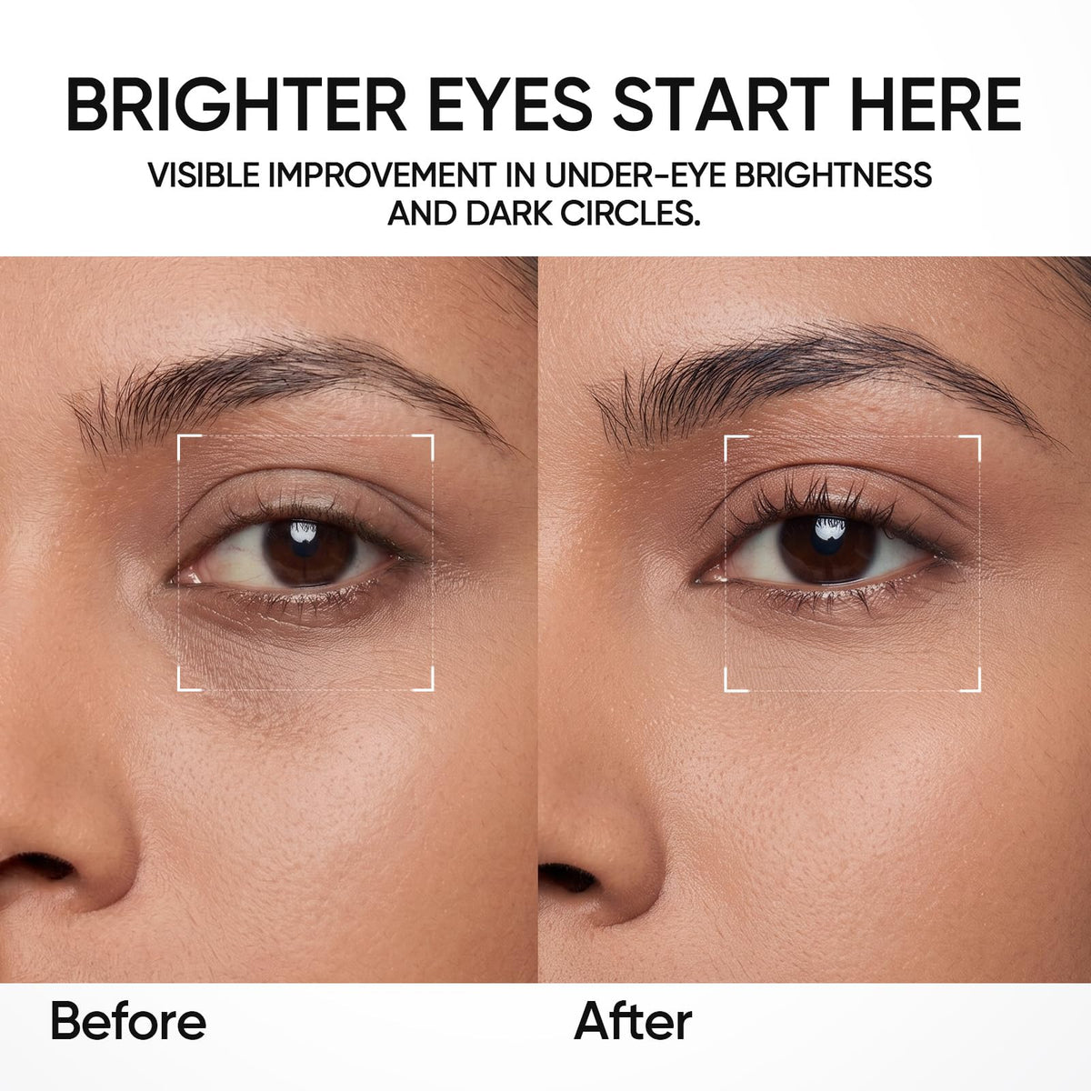 SKINTIFIC Lifting Eye Cream Reduce Puffiness fine lines Dark - SKINTIFIC Official Imagery - 8