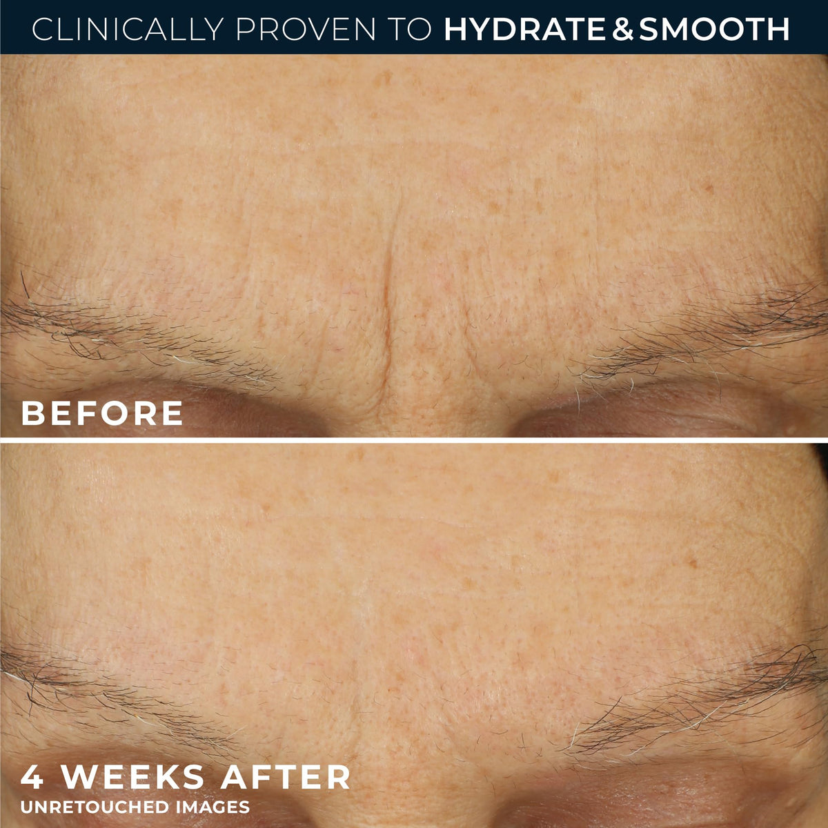 RoC Retinol Correxion Max Daily Hydration Face Moisturizer - RoC Official Imagery - 6
