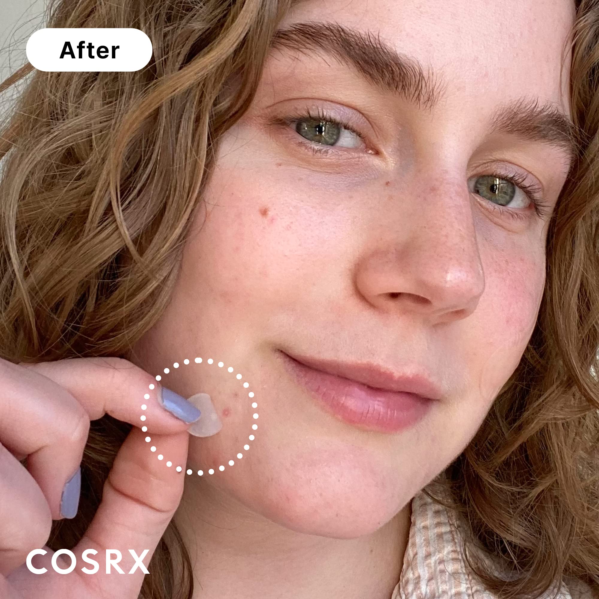 COSRX Acne Pimple Patches Absorbing Hydrocolloid Spot, 3 Size - COSRX
