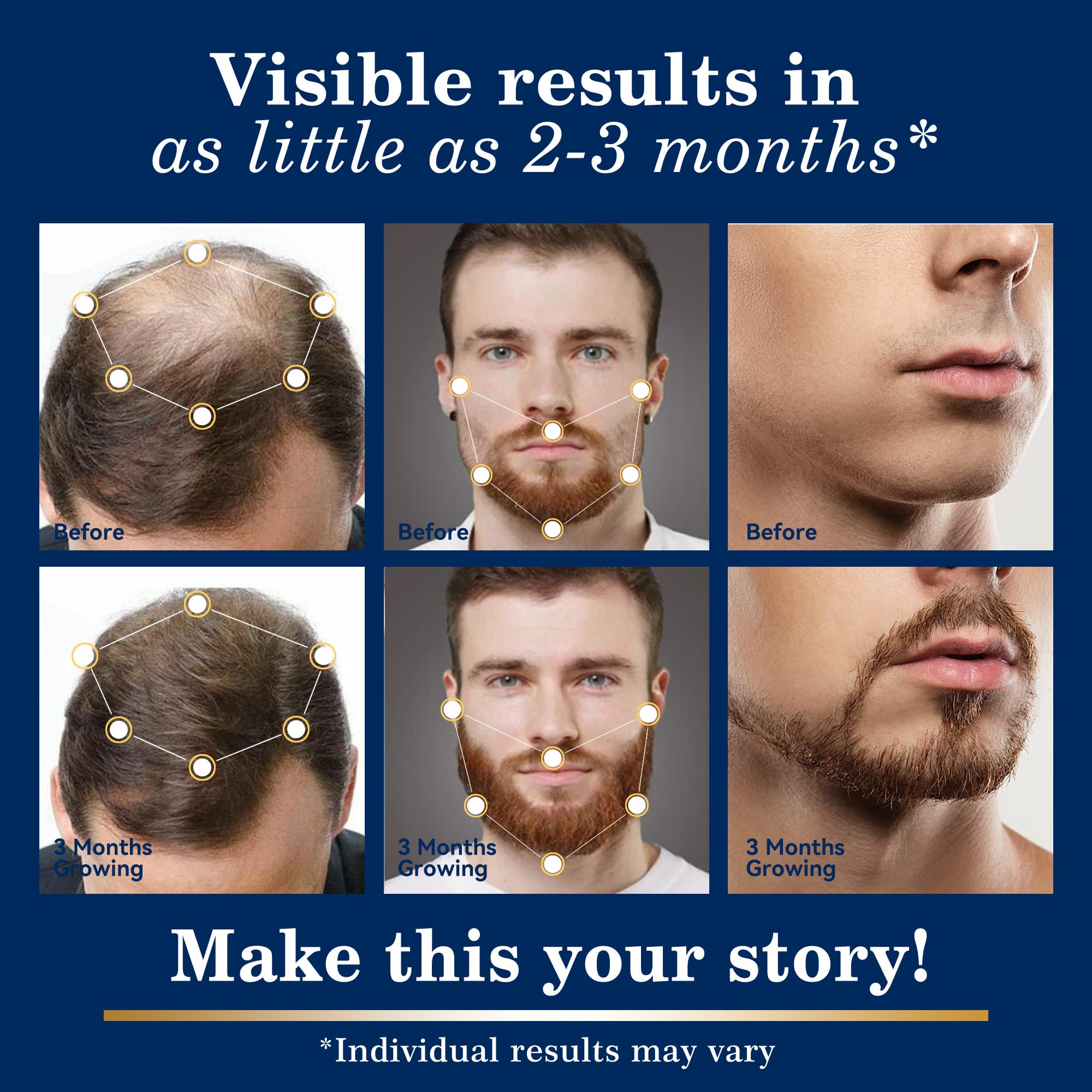 5% Minoxidil Hair & Beard Regrowth Spray Kit – DAAZZS