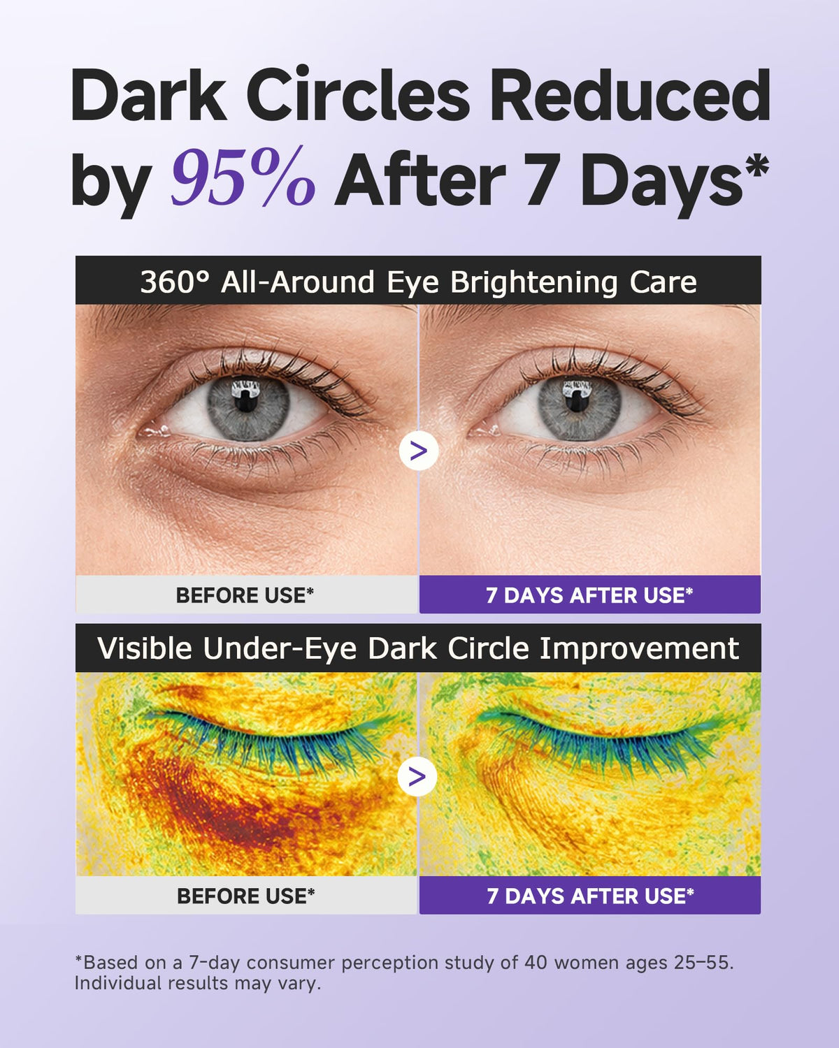 Under Eye Cream for Dark Circles Wrinkles with Niacinamide - 本桑製薬 Official Imagery - 4