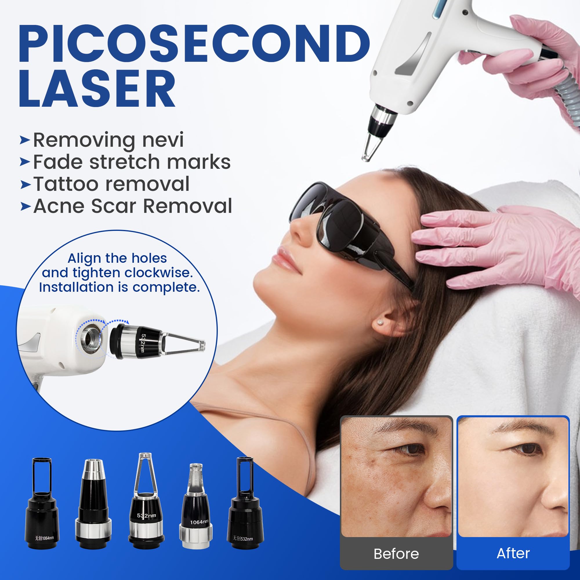 Generic 10-Bar 2-in-1 808nm laser hair removal machine with FAC tech for effective at-home beauty treatments.