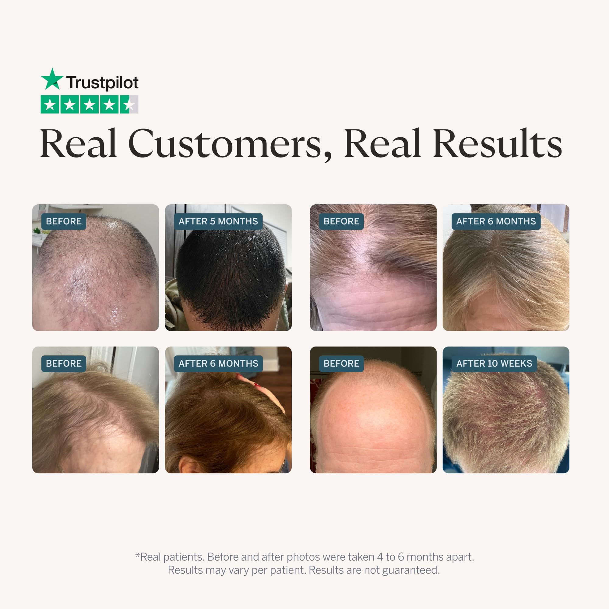 Happy Head Hair Serum for Men Women with Procapil Biotin - Happy Head Official Imagery - 3