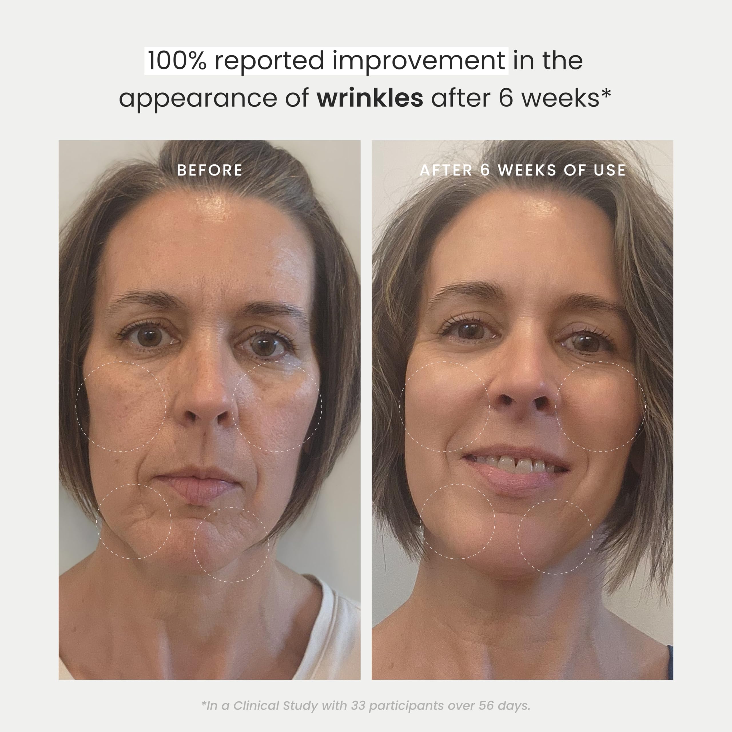 The Spa Dr. Antioxidant Serum - Anti Aging Skin Care 30 Day Supply Saf - The Spa Dr. Official Product View 7