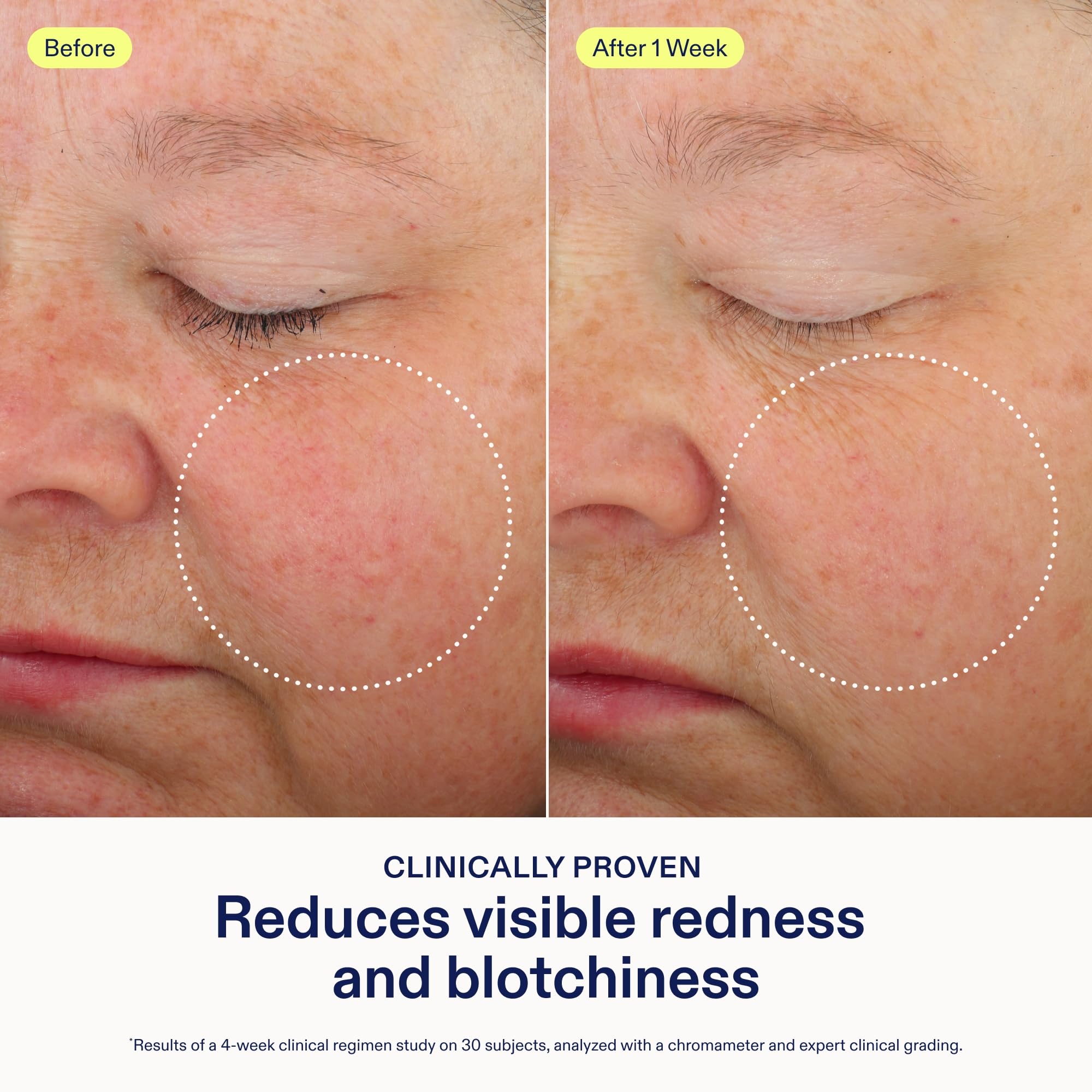 Skinfix Antioxidant Tetrapeptide Soothing Treatment - Skinfix