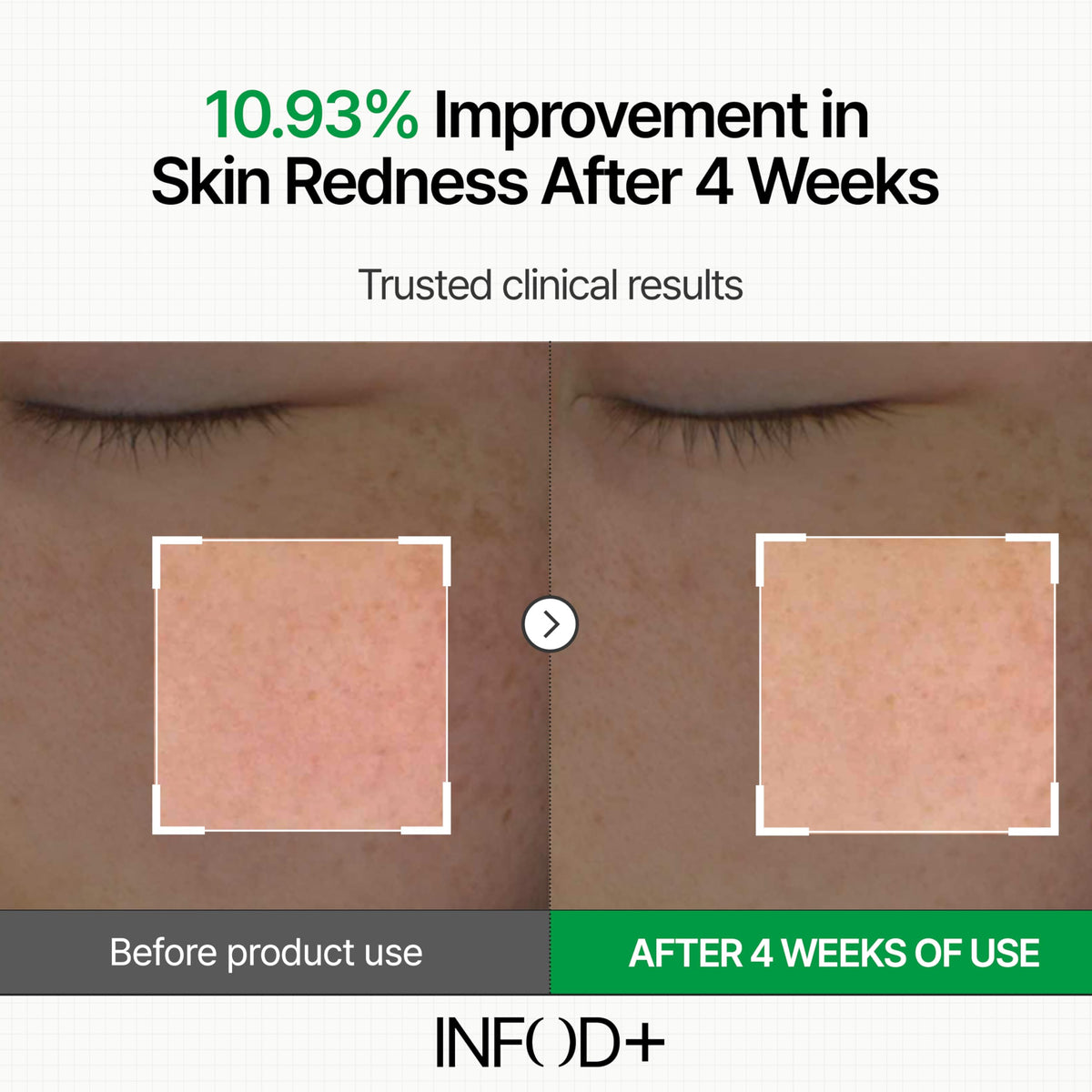 INFODPLUS Sensitive Skin Moisturizer Face Cream with - INFOD+ Official Imagery - 5
