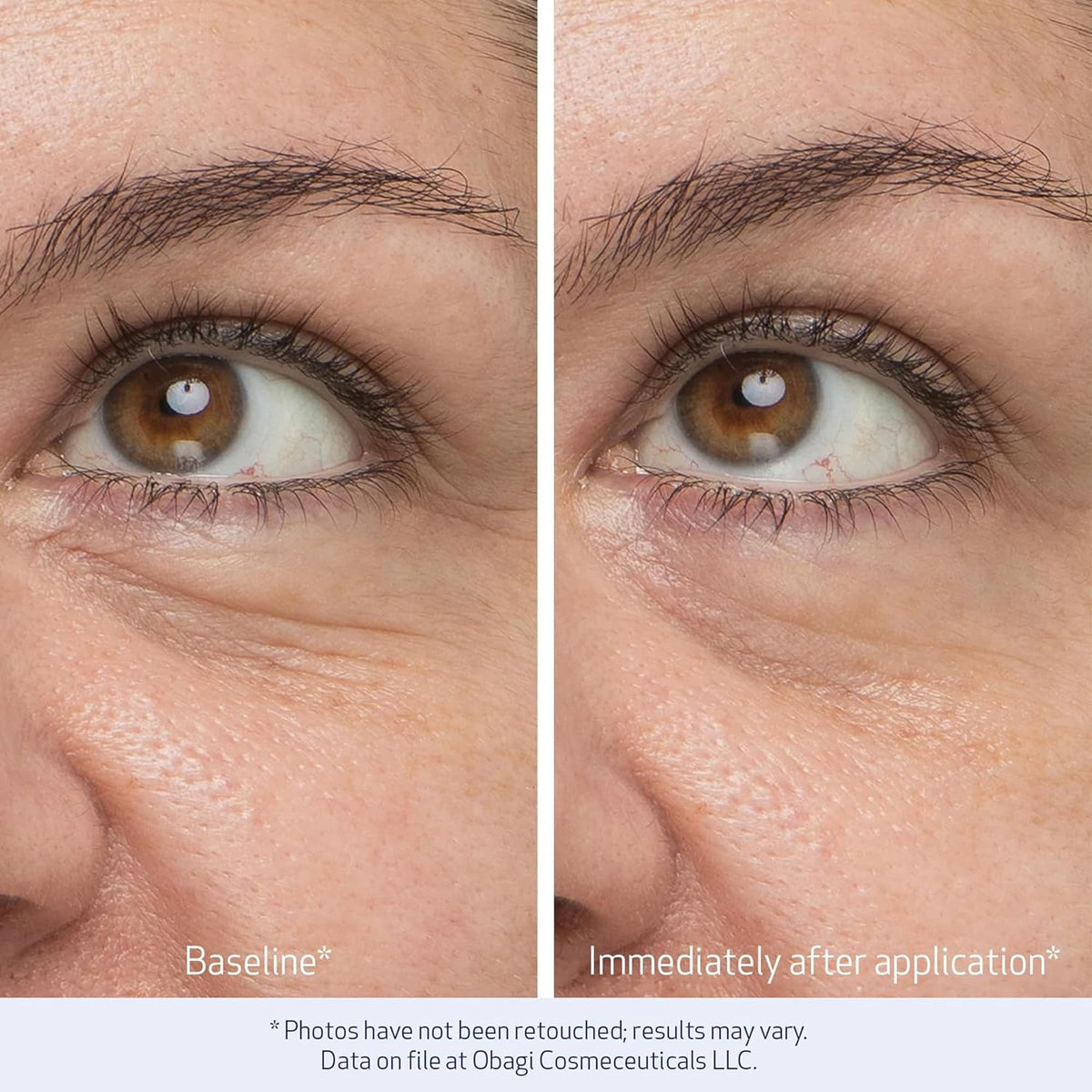 Obagi Daily Hydro Drops Rejuvenating Eye Gel Cream - Premium Selection Official Imagery - 6