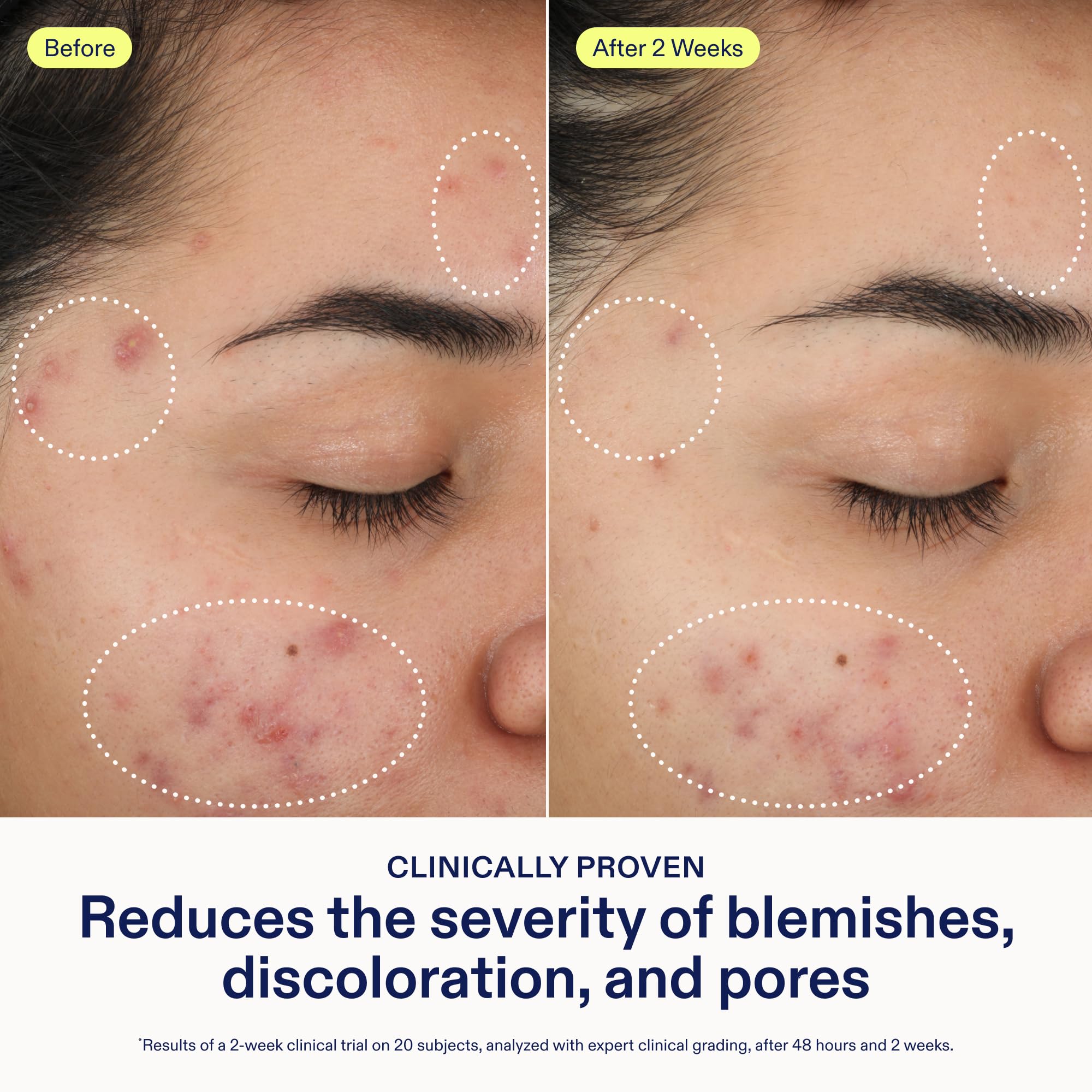 Skinfix 2 BHA Cleanser - Skinfix Official Imagery - 5