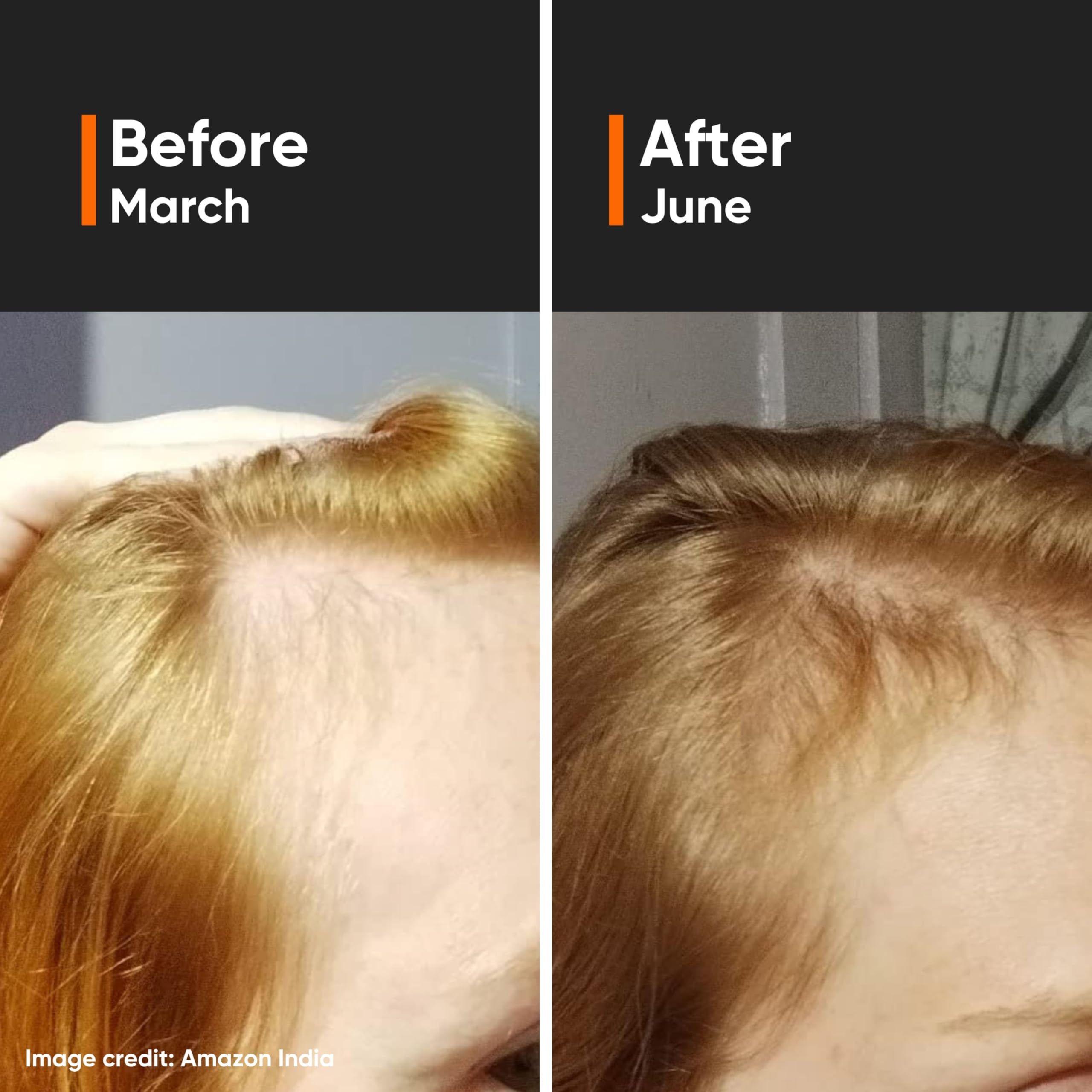 Minimalist Hair Density Serum 18% - Hair Growth Serum With Procapil & Capi - Minimalist Official Product View 10