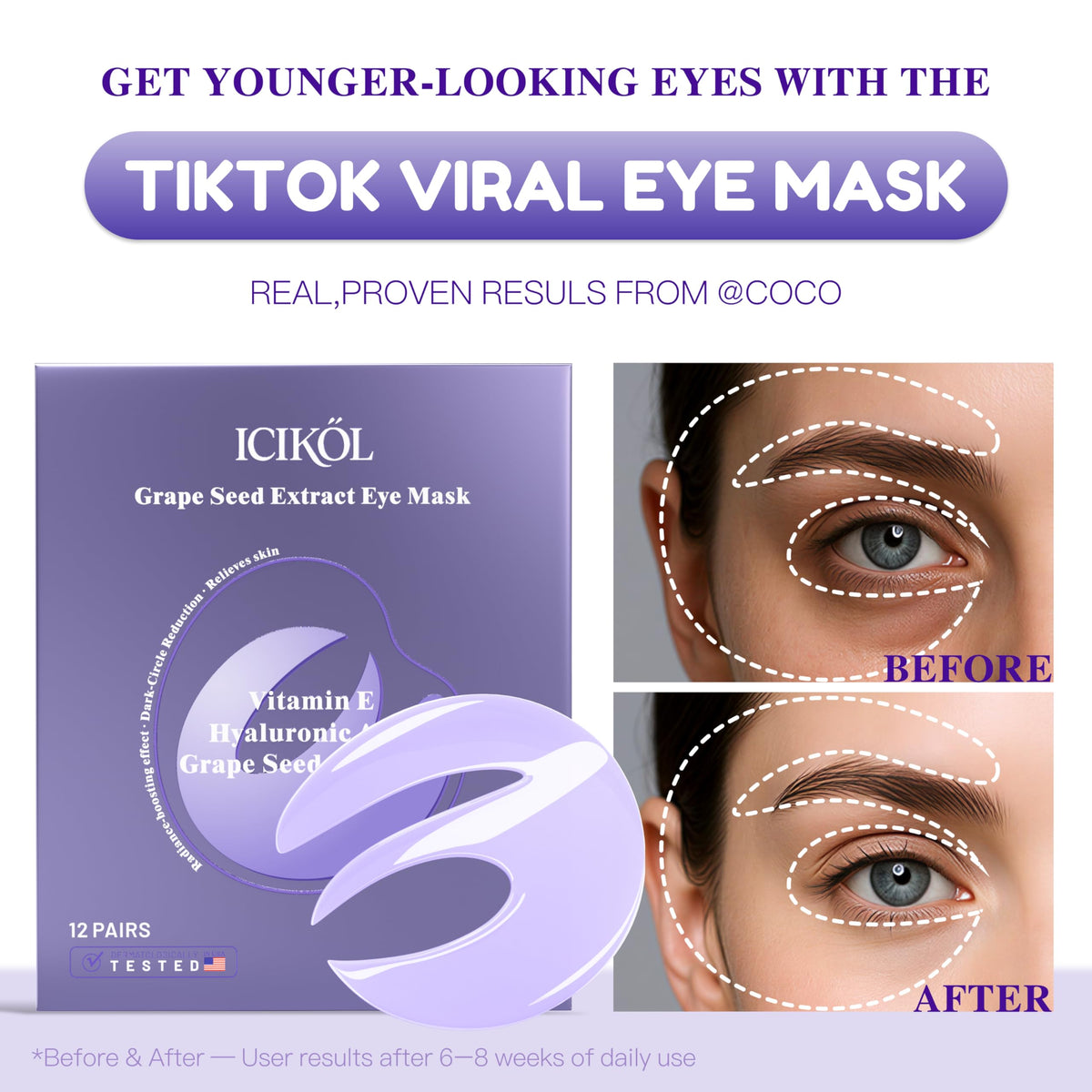 Under Eye Patches with Grape Seed Extract Eye Patches for - ICIKOL Official Imagery - 5