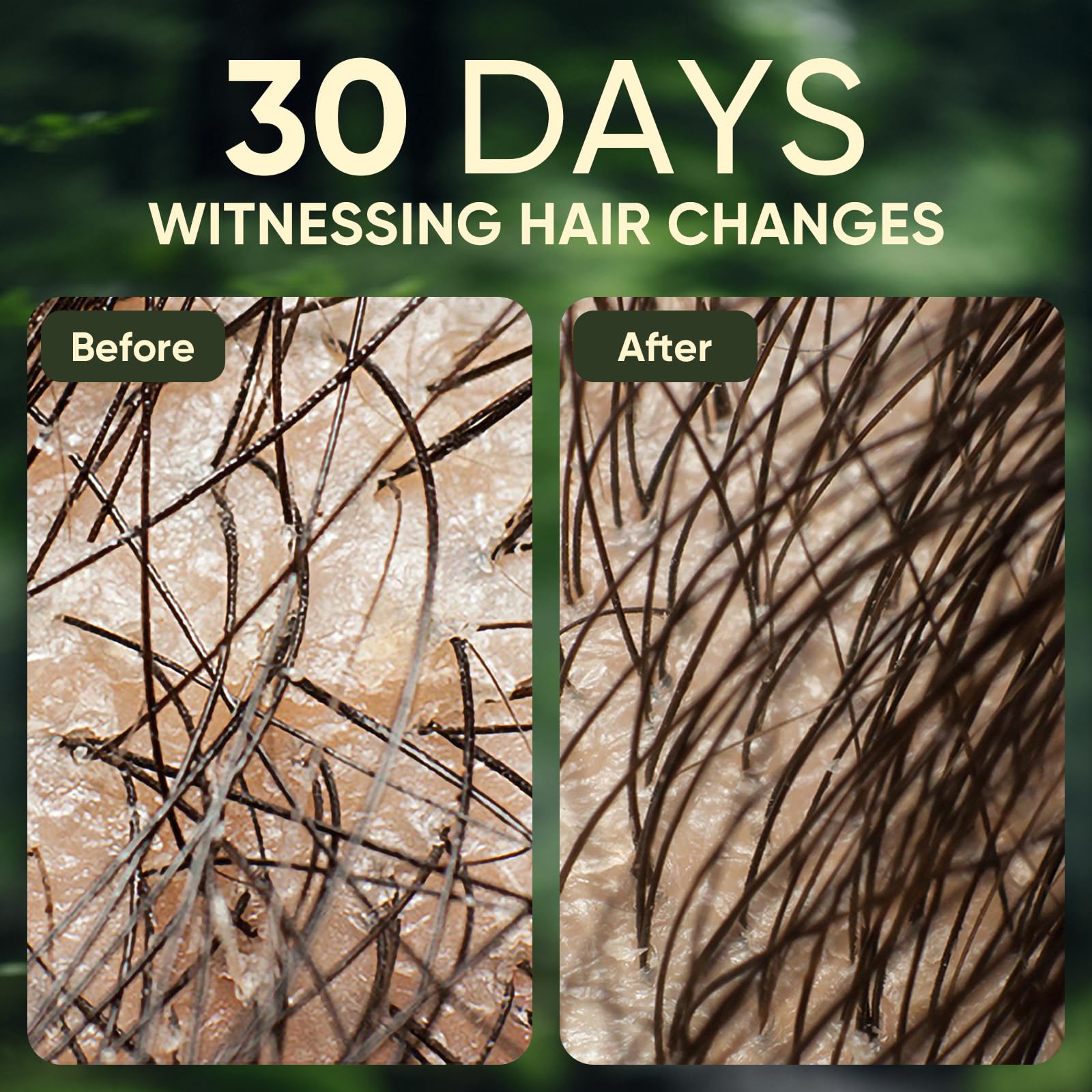 Agodafoo Batana Oil Shampoo for Hair Growth, Batana Oil & Rosemary Oil Shampoo - Agodafoo Official Product View 8