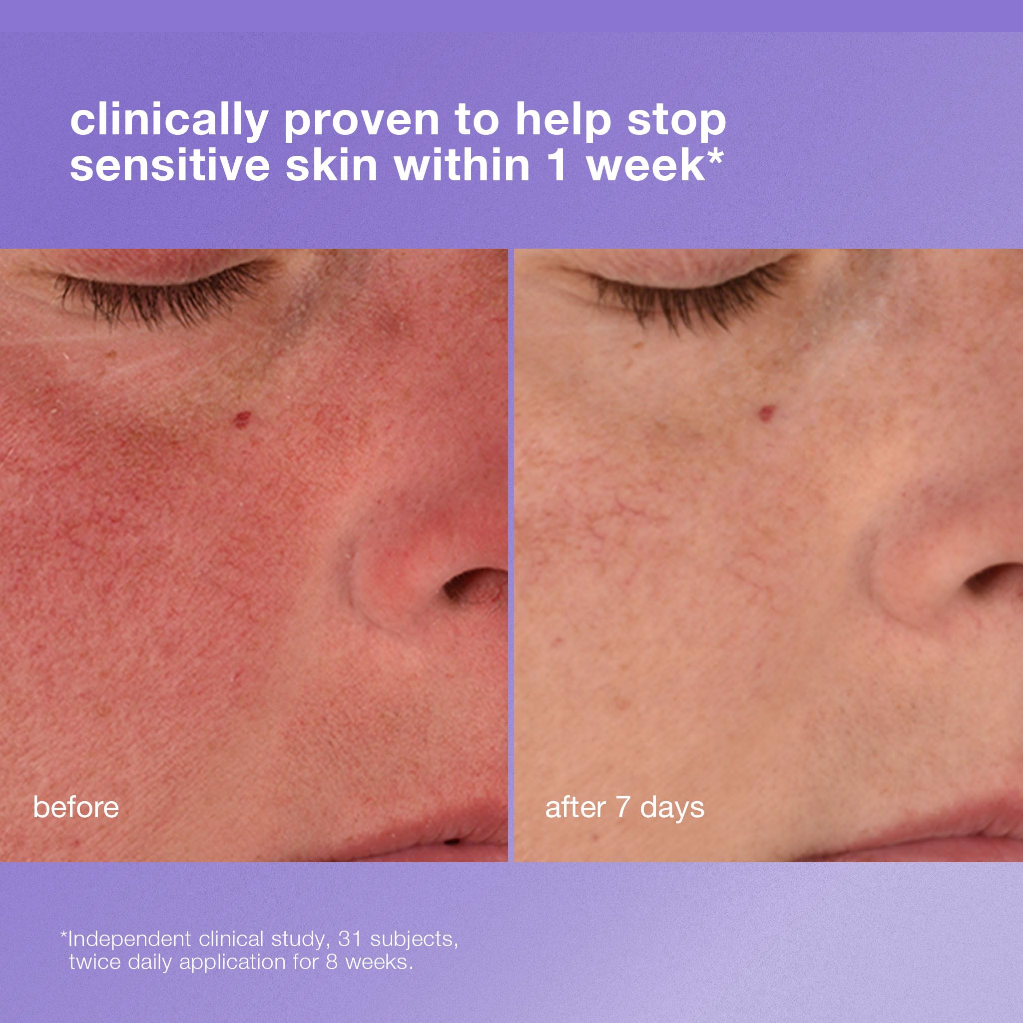Dermalogica Stabilizing Repair Cream Sensitive Skin - Premium Selection Official Imagery - 4