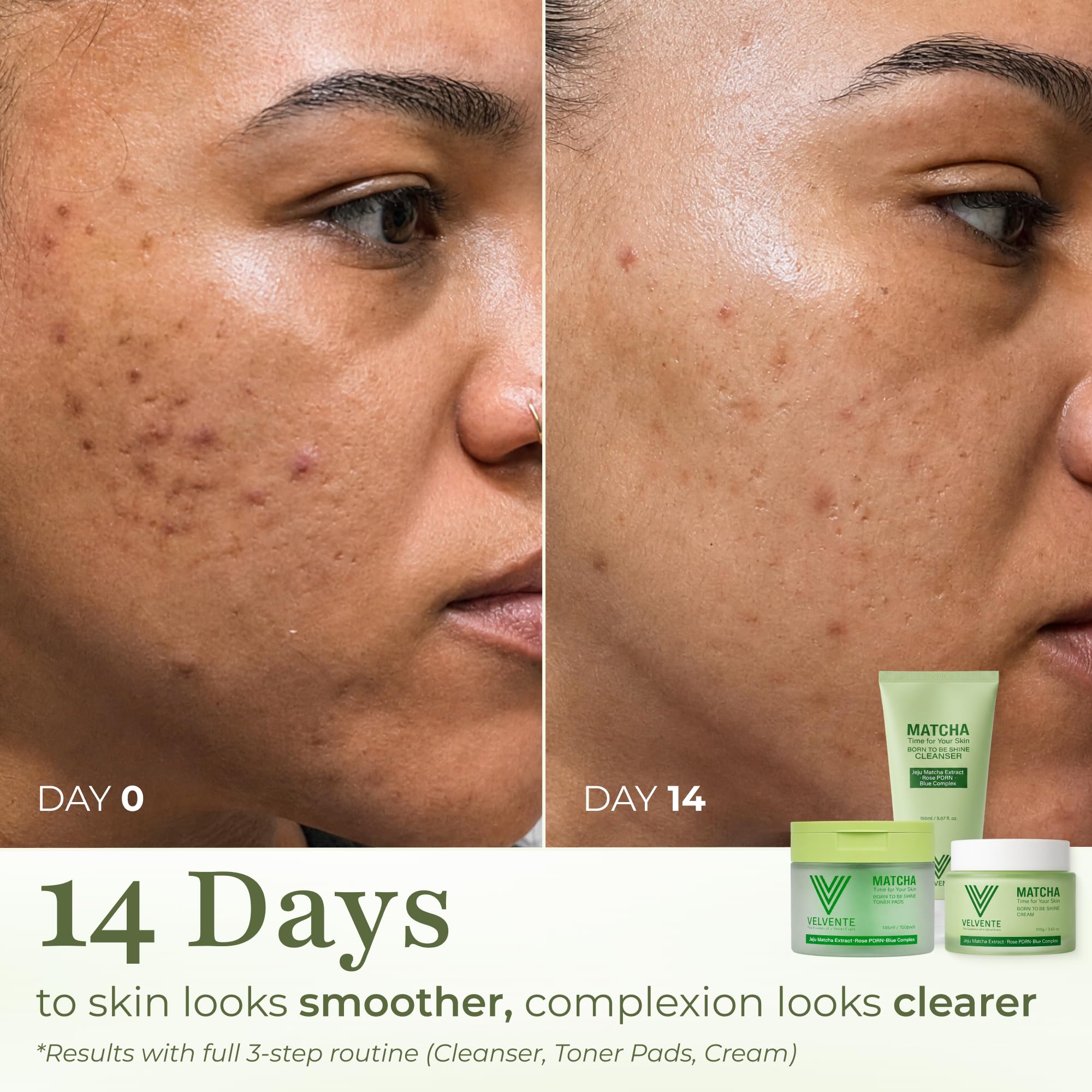 Matcha PDRN Korean Cleanser & Face Wash, Acne-Prone Sensitive... - VELVENTE Official Product View 9