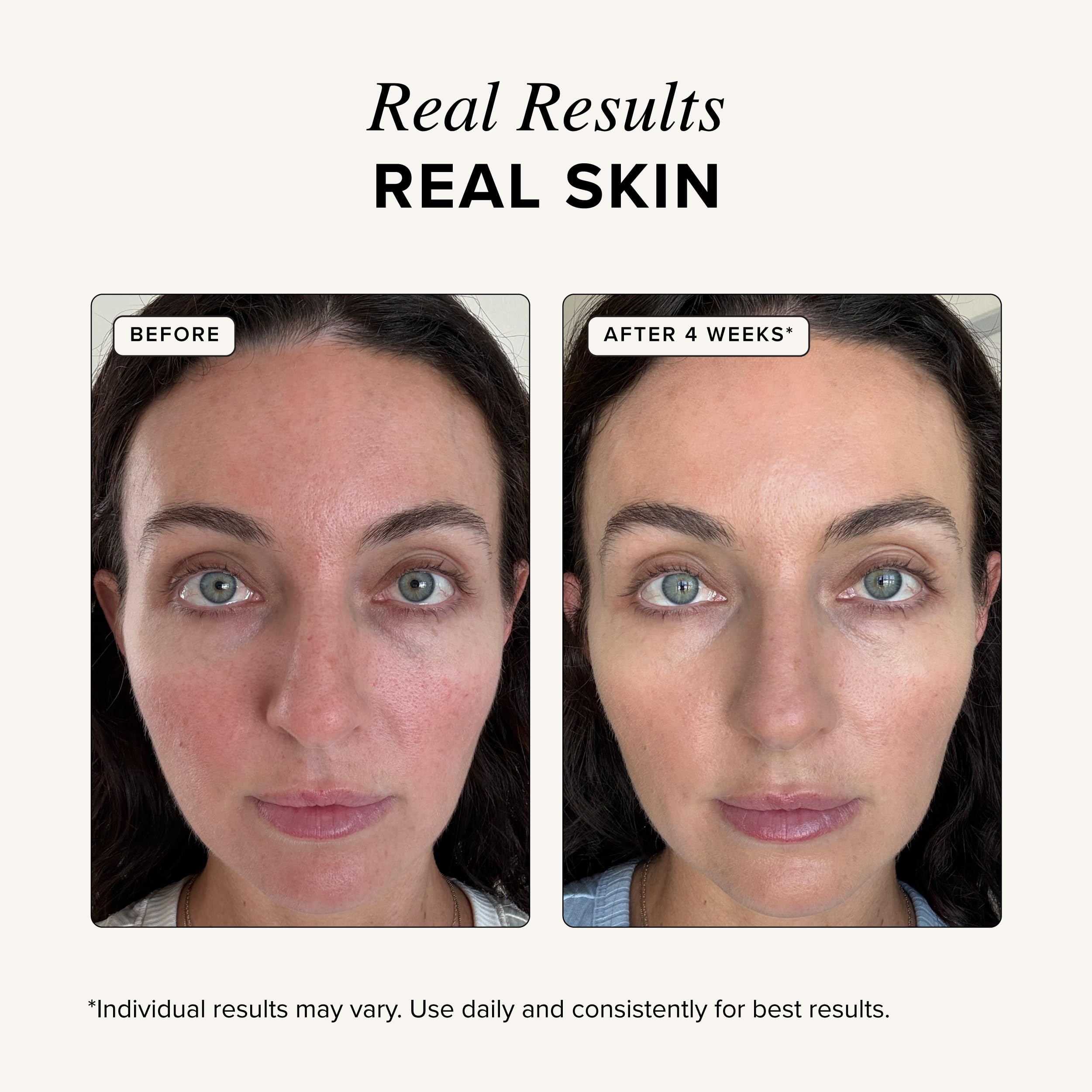 Asterwood Copper Peptides Serum for Face GHK Cu Peptide w - Asterwood Official Imagery - 6