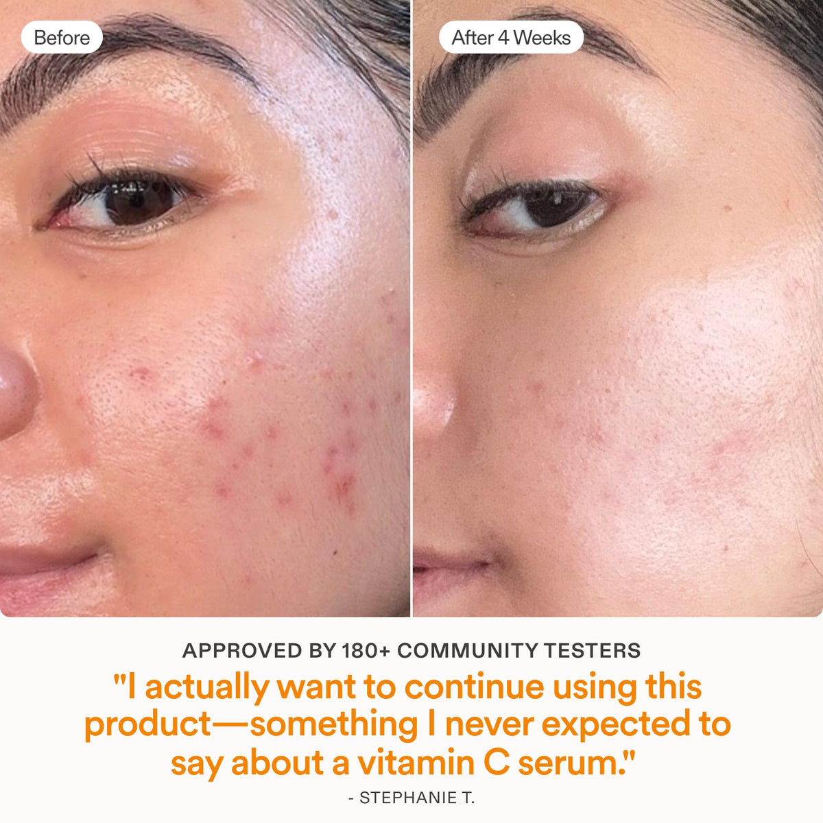 Skinfix Brighten Firm 15 Vitamin C Serum for Face - Skinfix Official Imagery - 7