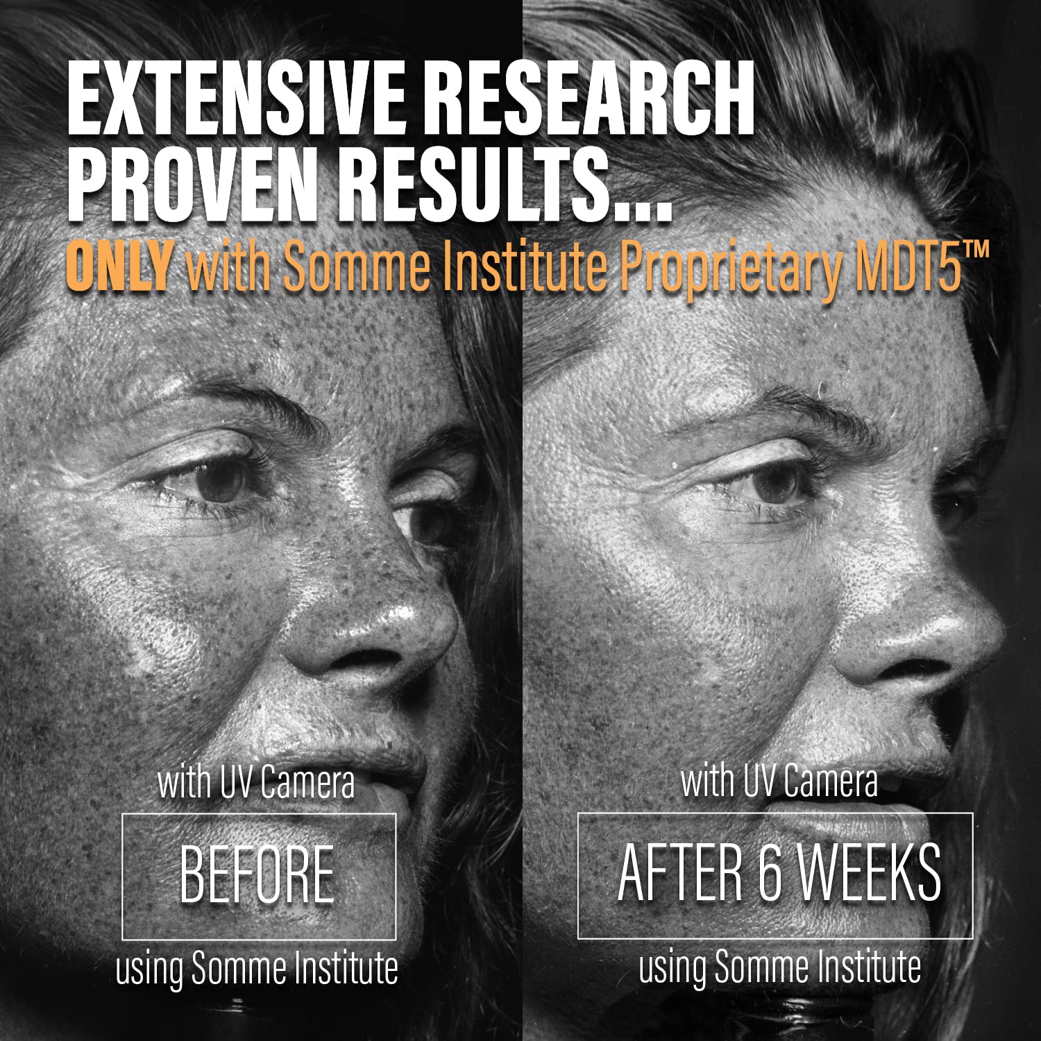 Anti-Aging Vitamin C Serum with MDT5™ - Somme Institute