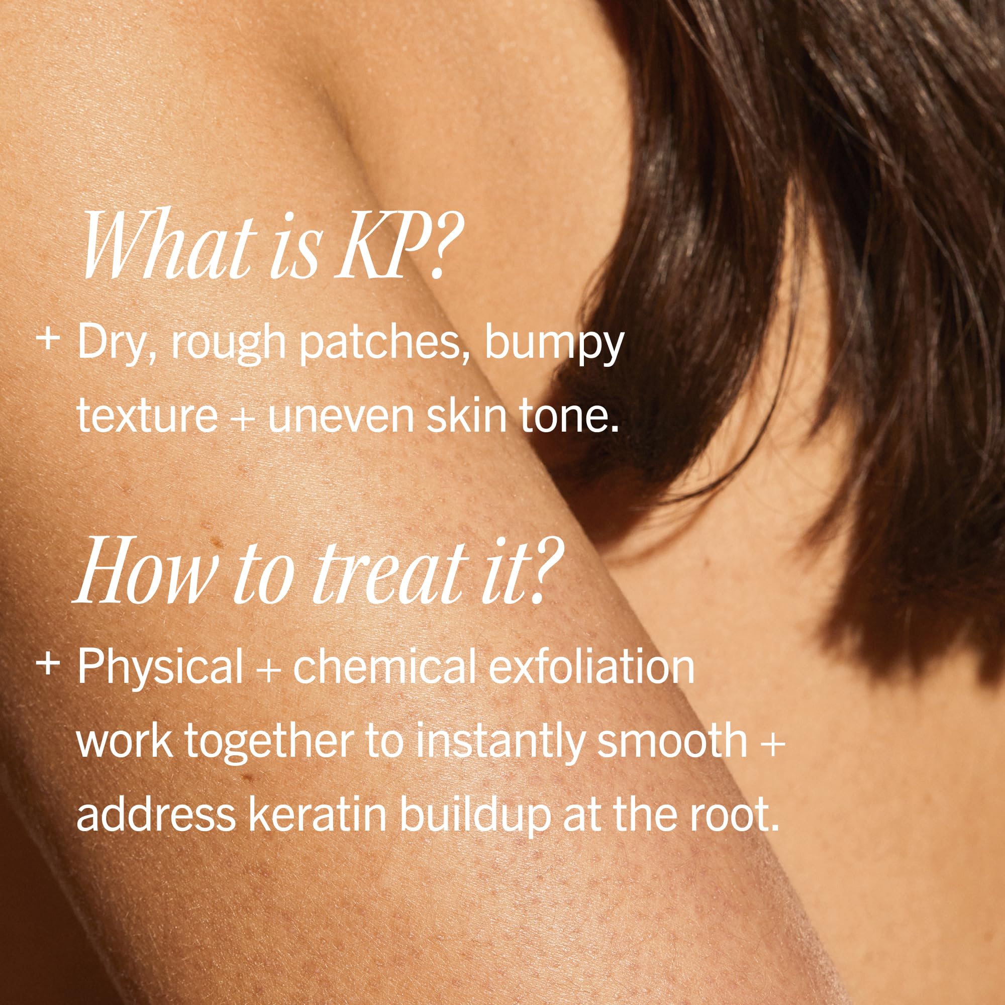 Elefair Tech First Aid Beauty KP Bump Eraser Body Scrub with 10% AHA - - Elefair Tech Official Product View 6